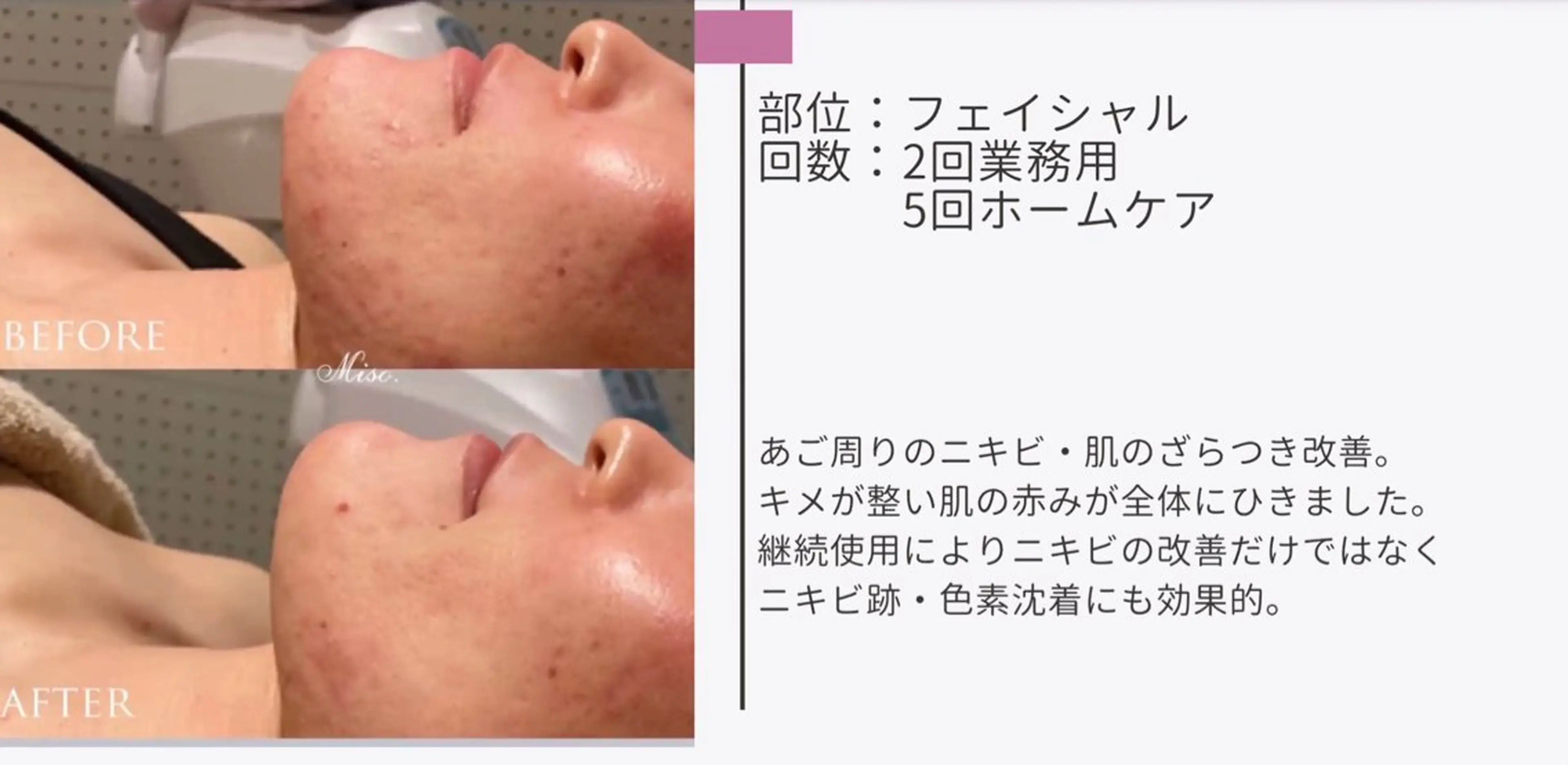 艶肌ワックス ALLY.のエステ・リラクイメージ