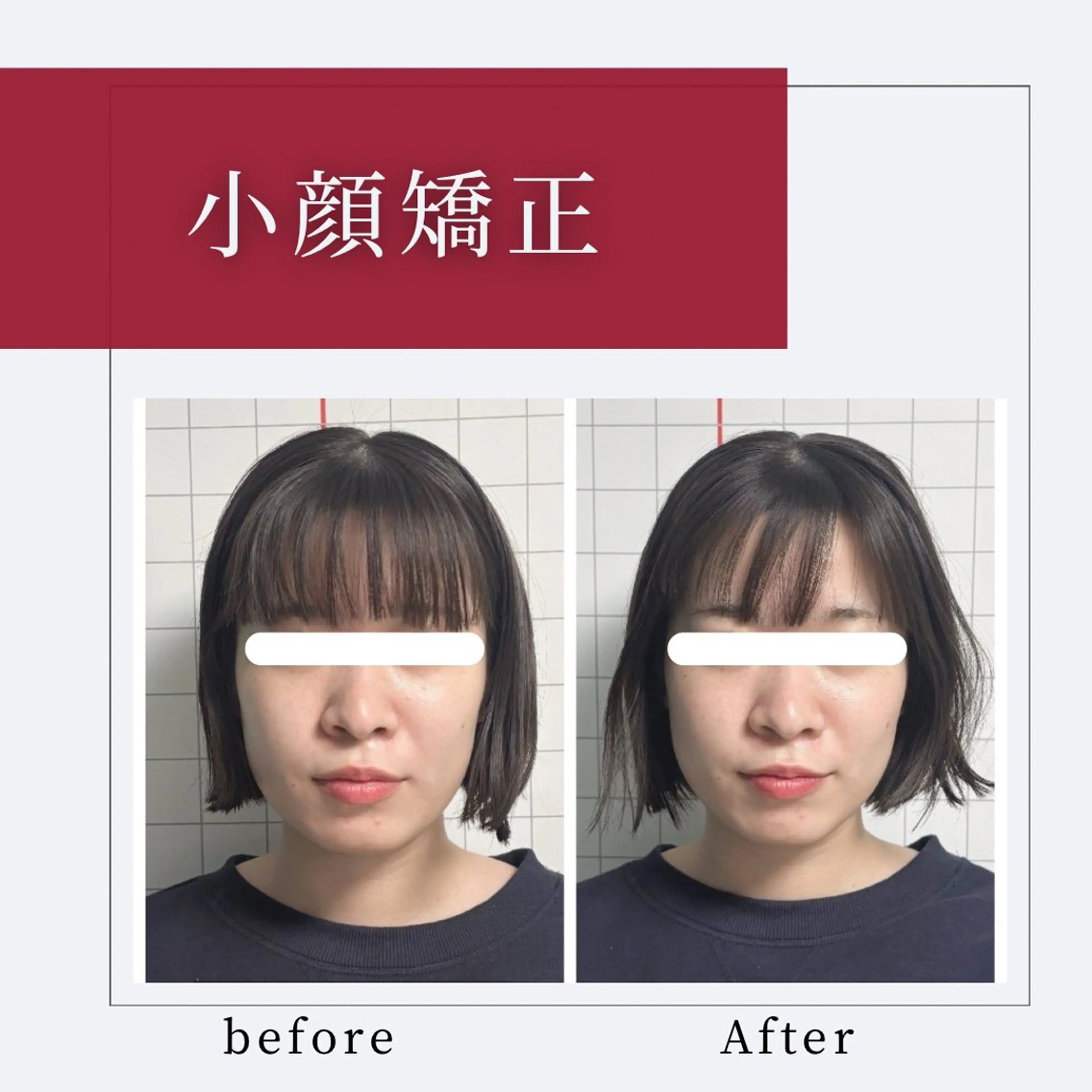 小顔矯正専門店 【RED】池田のエステ・リラクイメージ