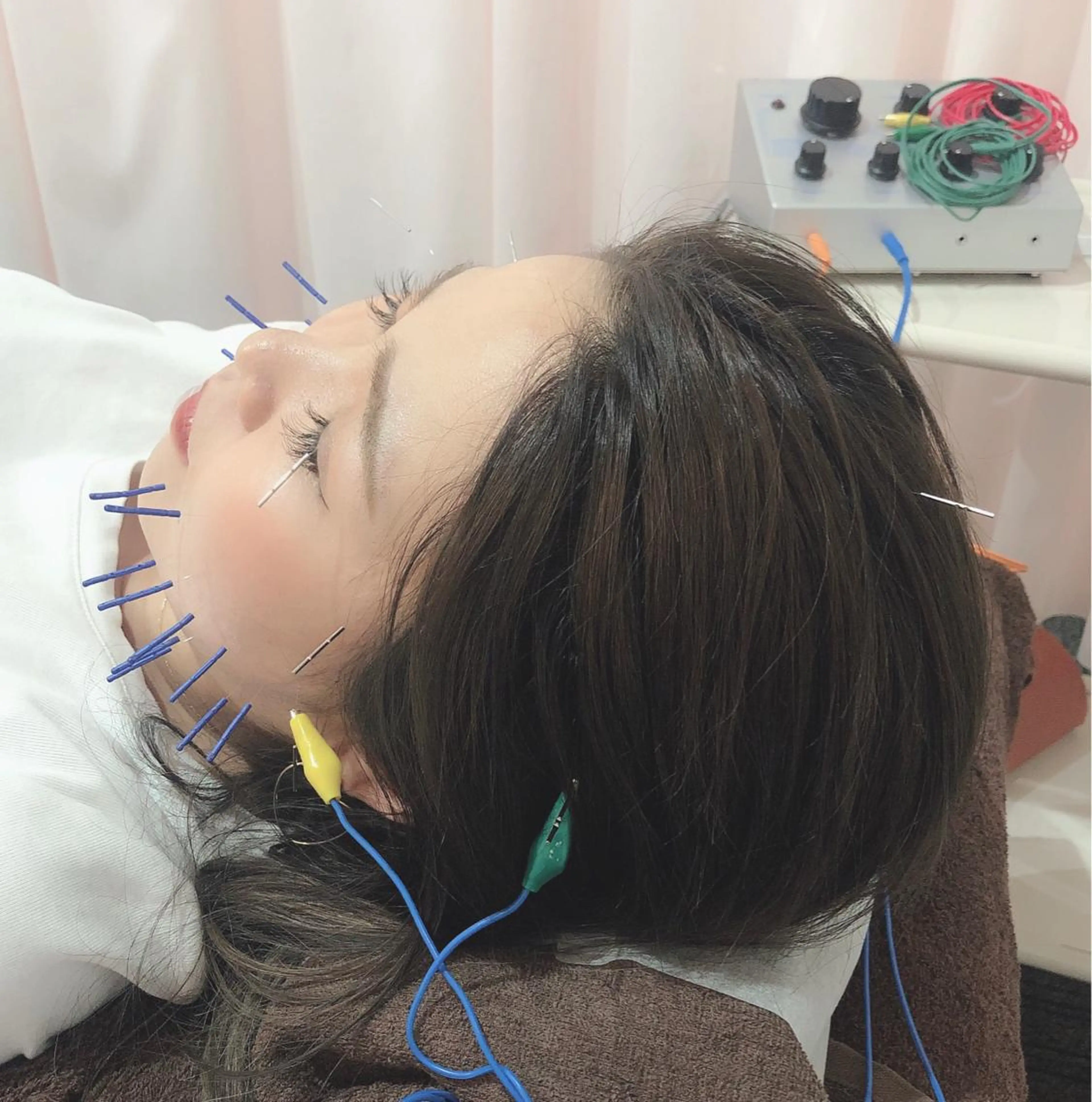 ✨ご好評につき12月も平日12時〜16時初回限定メニュー✨先着2名様✨美容鍼+鍼通電(パルス)+頭マッサージ✨の写真