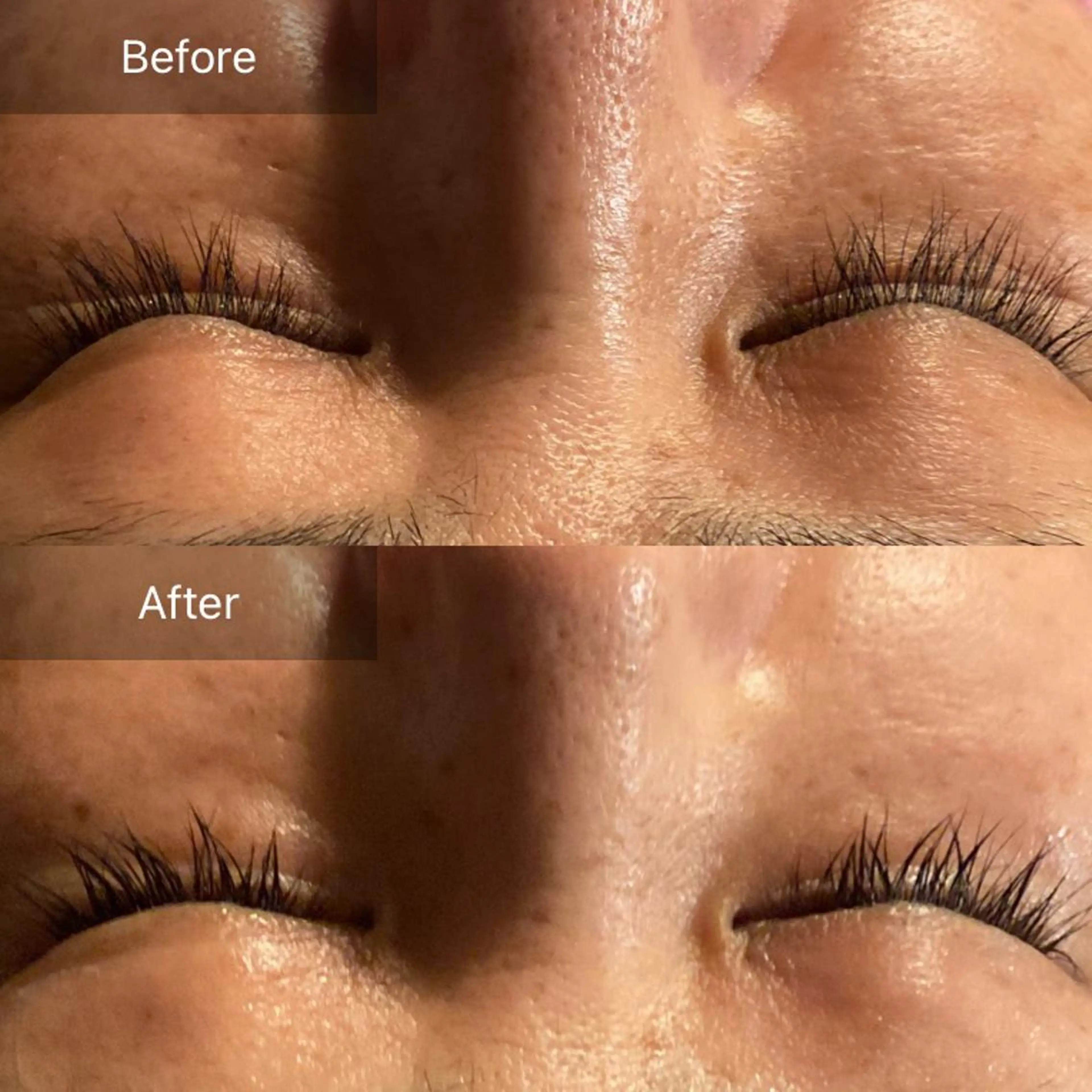 Mandarin Orange所属・毛穴から始める肌メン テマンダリンオレンジのエステ・リラクイメージ