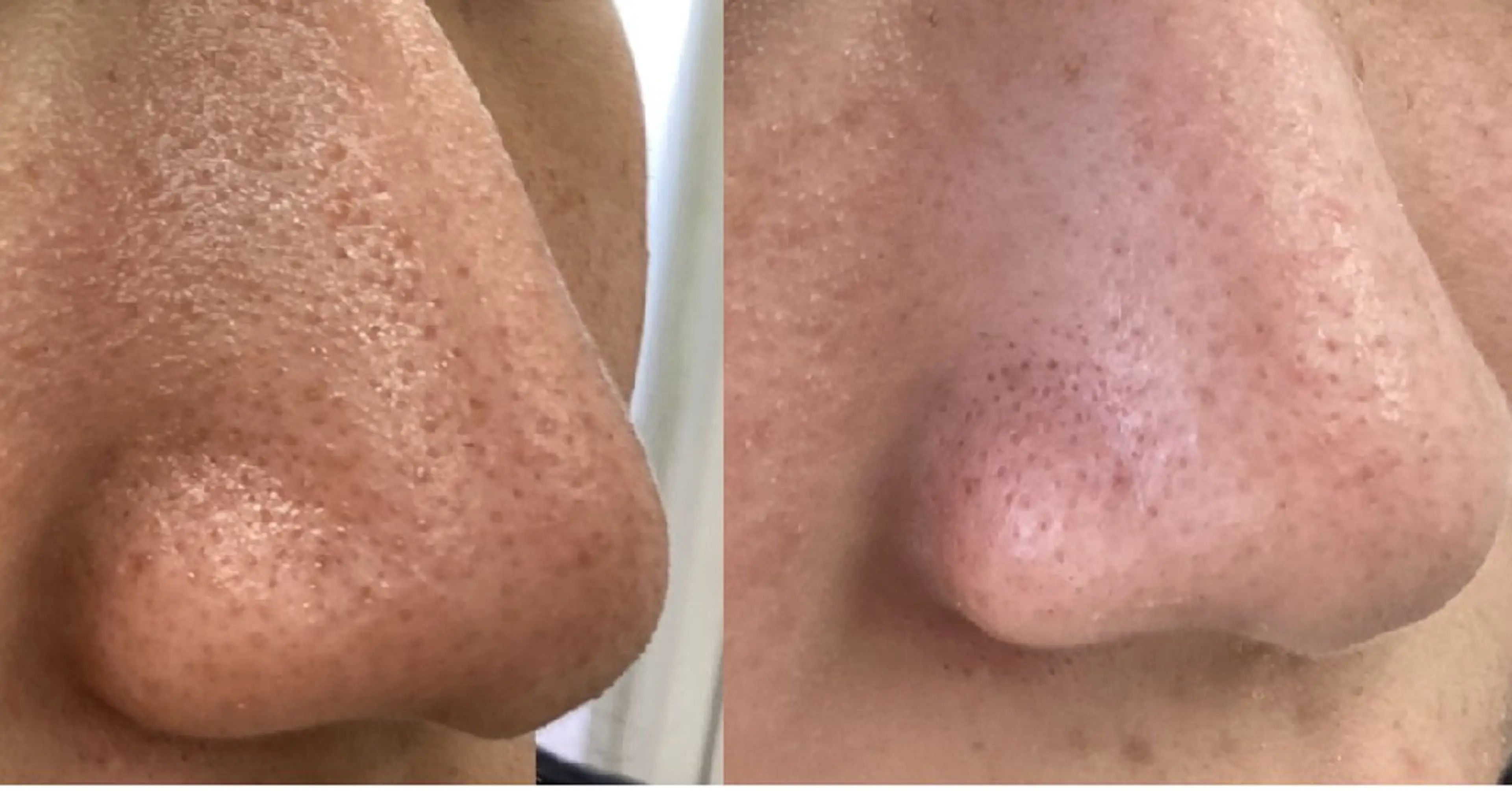 美肌専門サロン RUBONのエステ・リラクイメージ