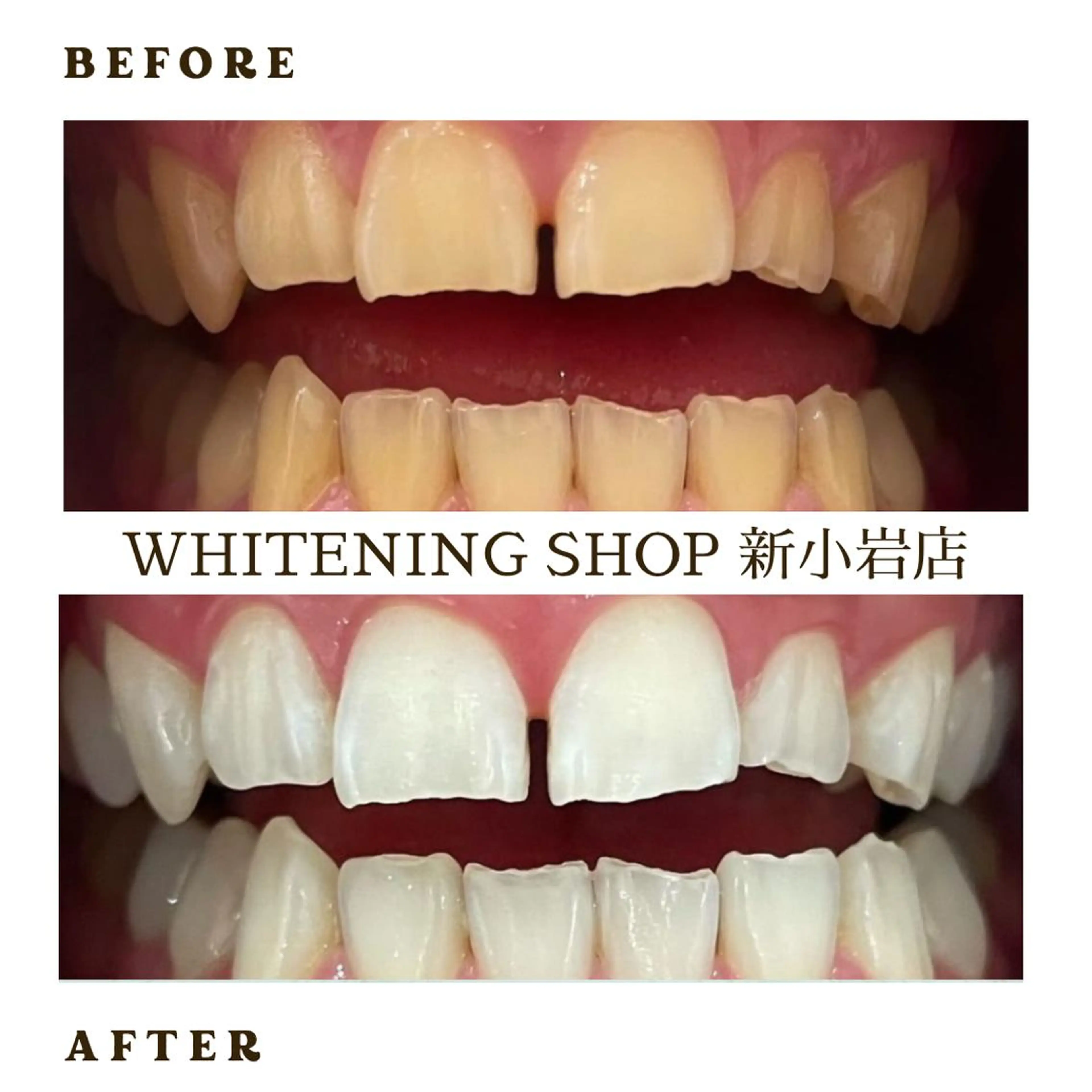 メンズ その他 ホワイトニング ショップ新小岩店のその他イメージ