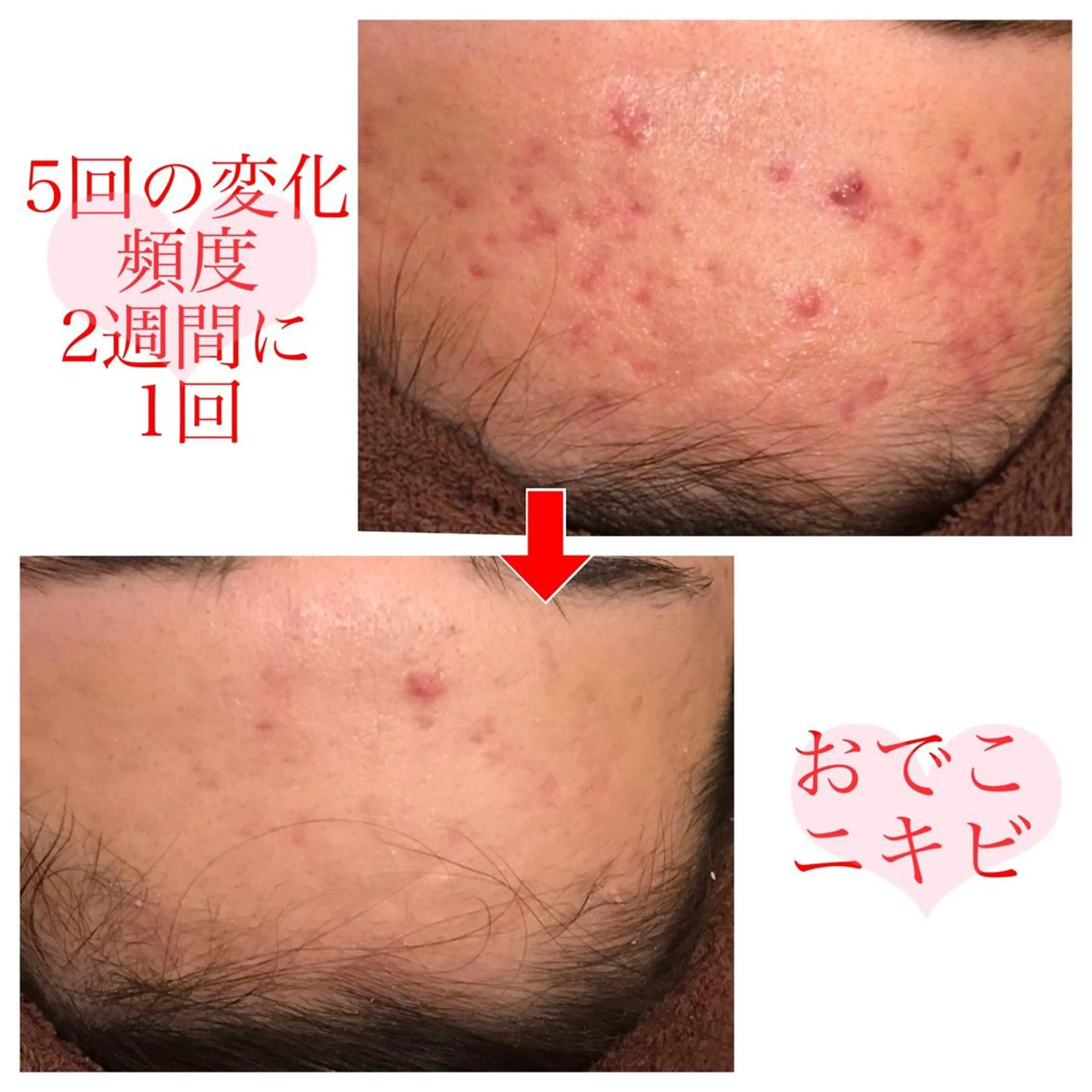 ミディアム カラー パーマ ヘアアレンジ メンズ キッズ ネイル マツエク・マツパ 四つ星サロン🎖 腸＆ニキビケアに特化のエステ・リラクイメージ