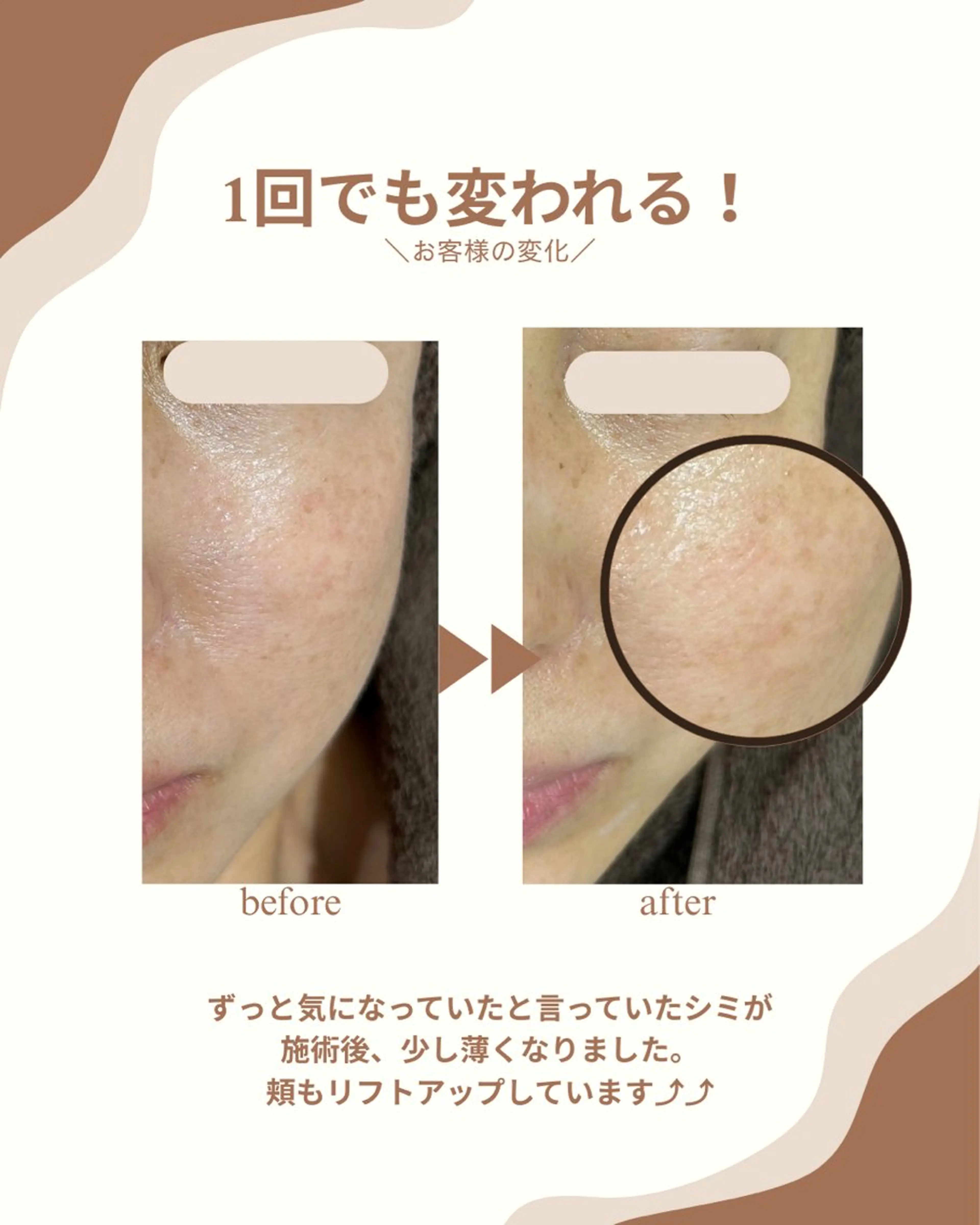 エステ リラク プライベートサロン COVOのエステ・リラクイメージ