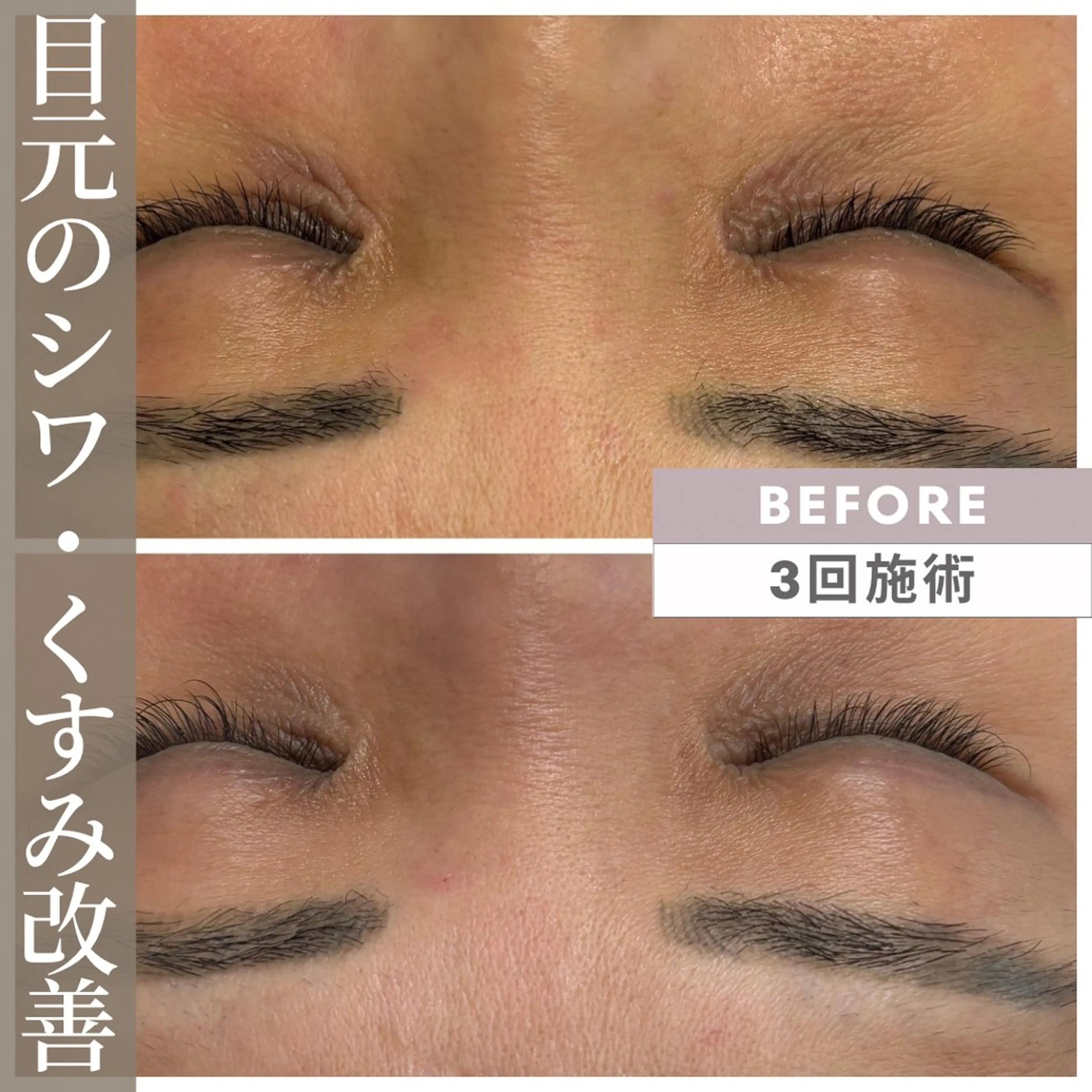 エステ 小顔矯正専門店 【RED】池田のエステ・リラクイメージ