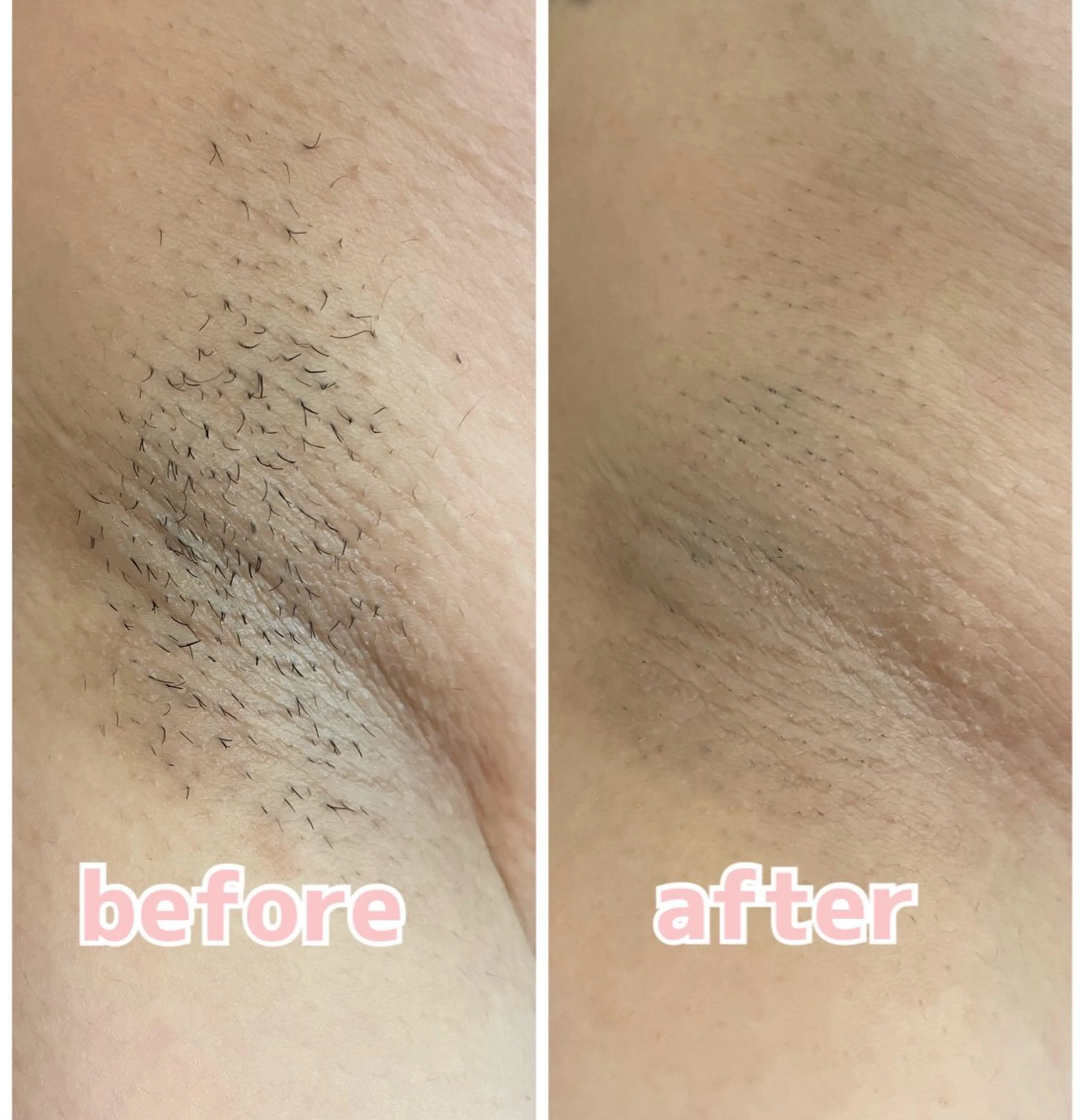 脱毛 韓国最先端技術サロン Luangeのエステ・リラクイメージ