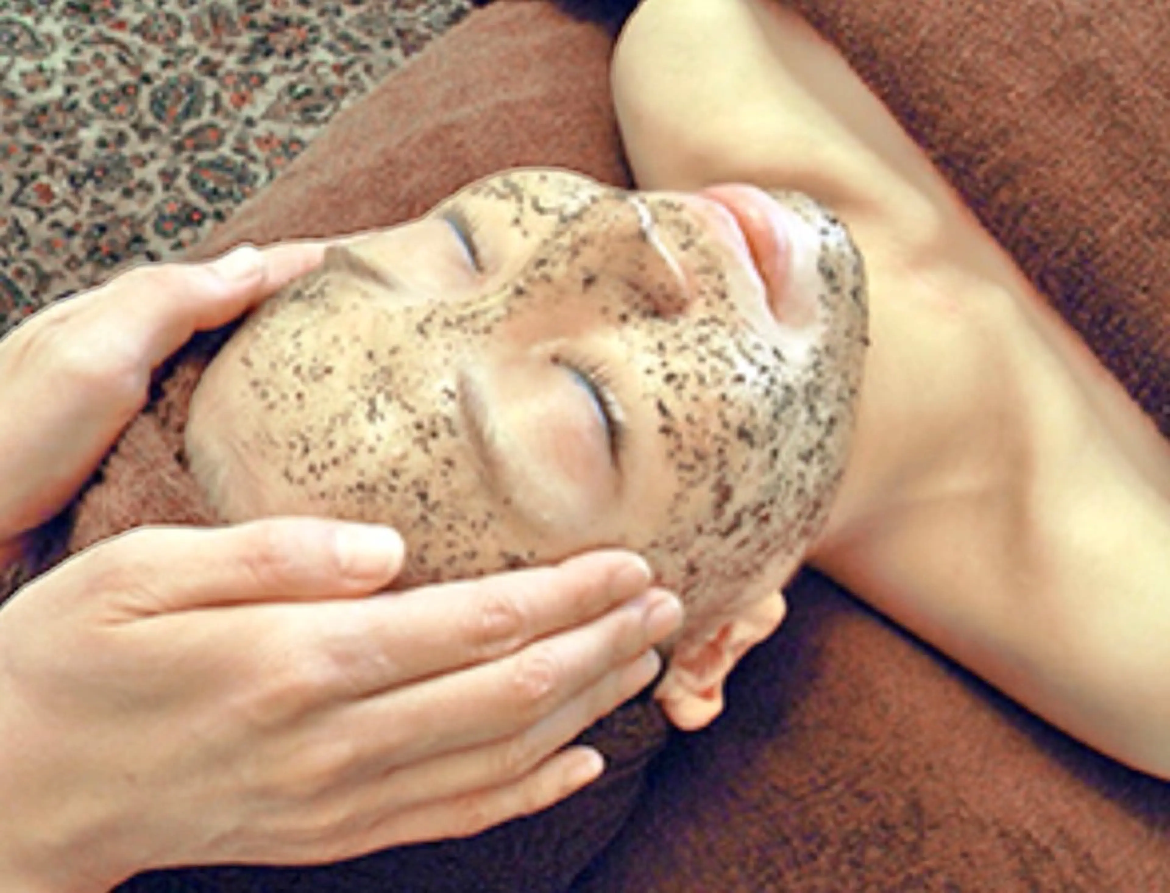 美顔ハーブピーリング(REVI)の写真