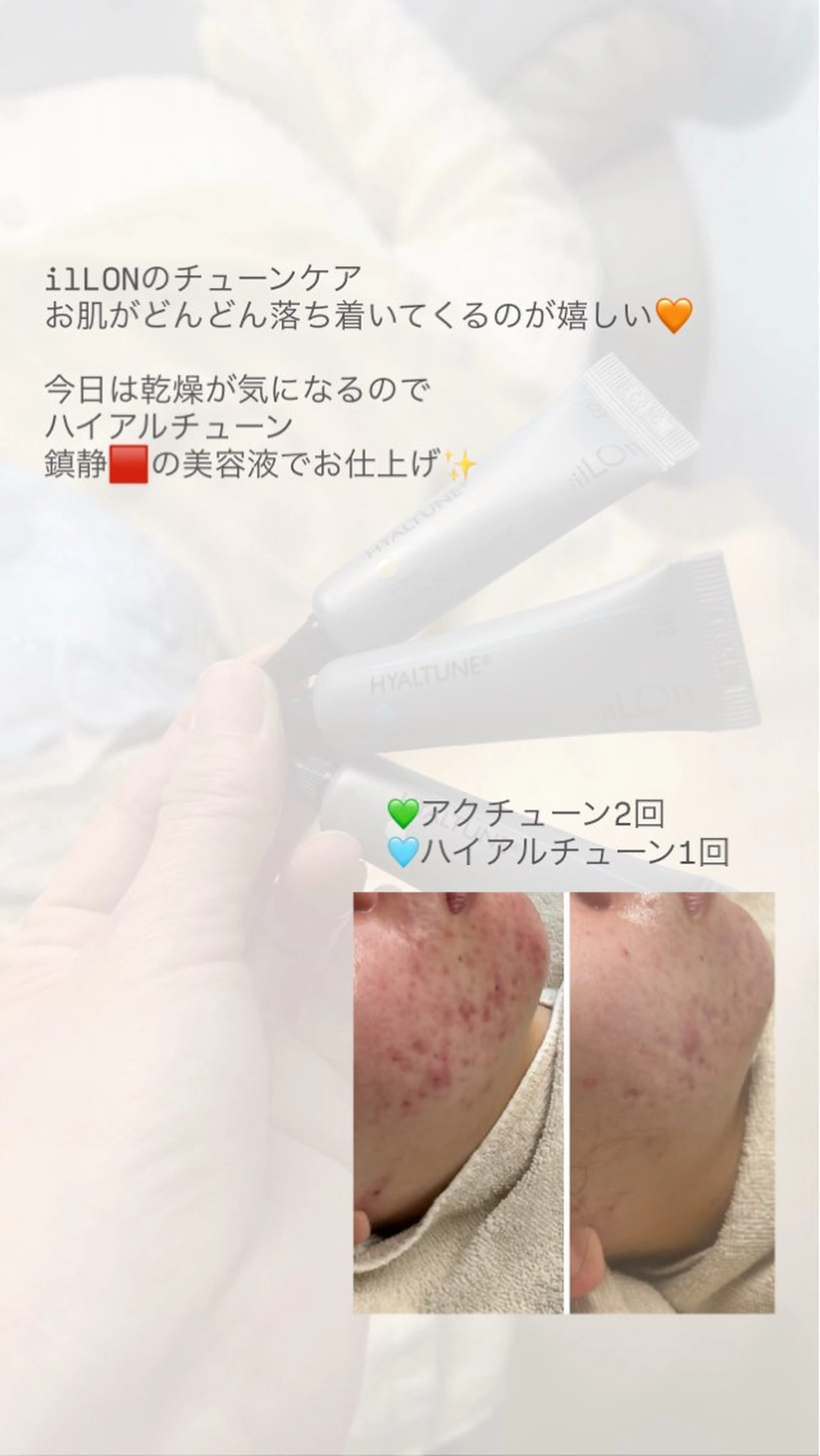 FAYUN.所属・FAYUN. 栗原詩織のエステ・リラクイメージ