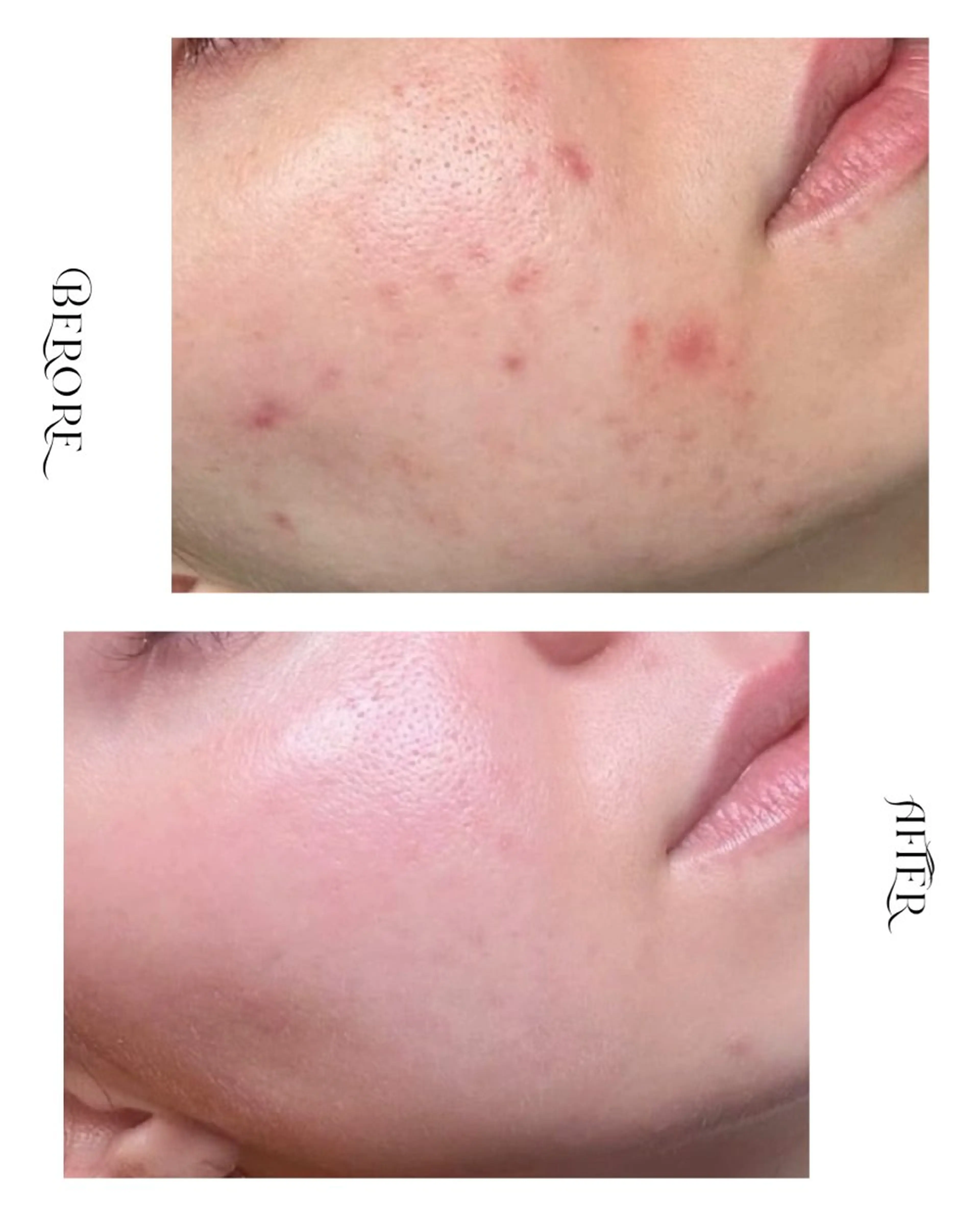 脱毛・肌質改善サロン Linoのエステ・リラクイメージ