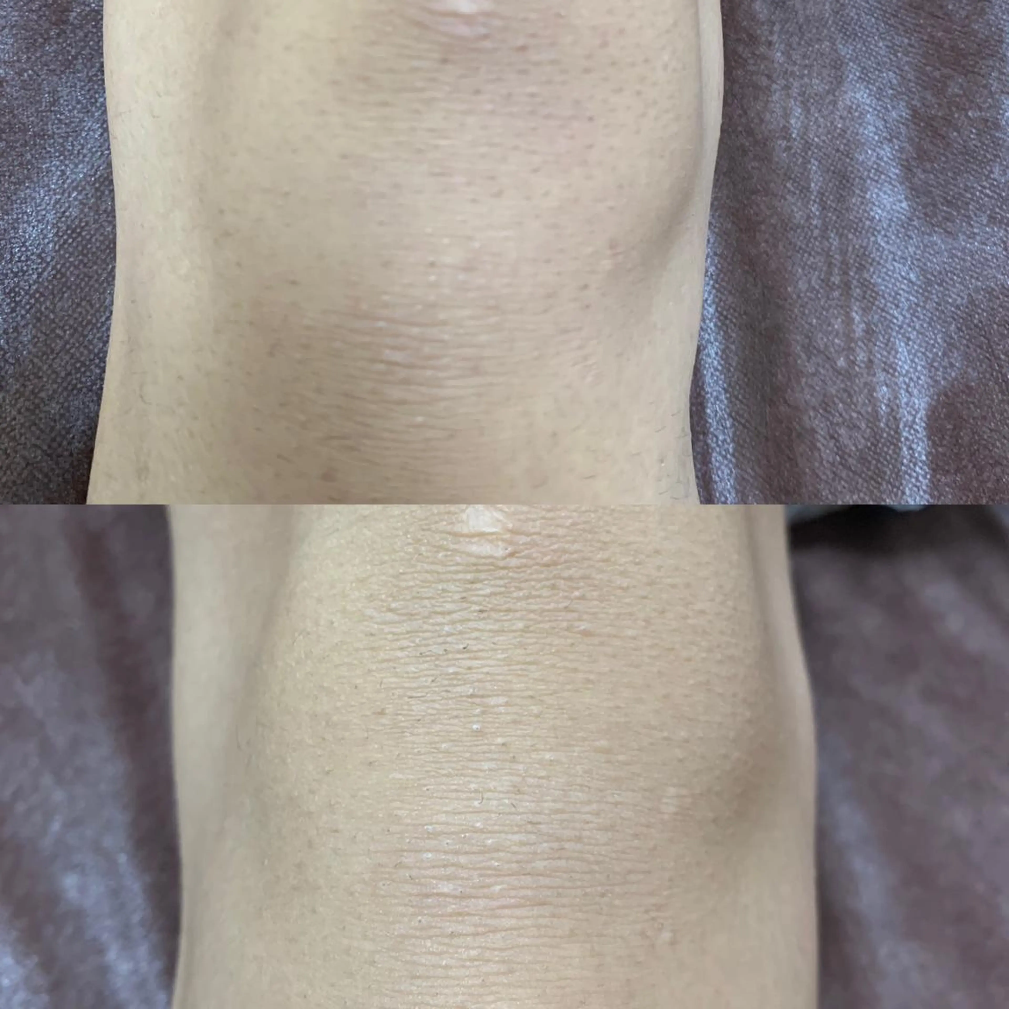 メンズ キッズ 脱毛SALON RaYNiCKのエステ・リラクイメージ