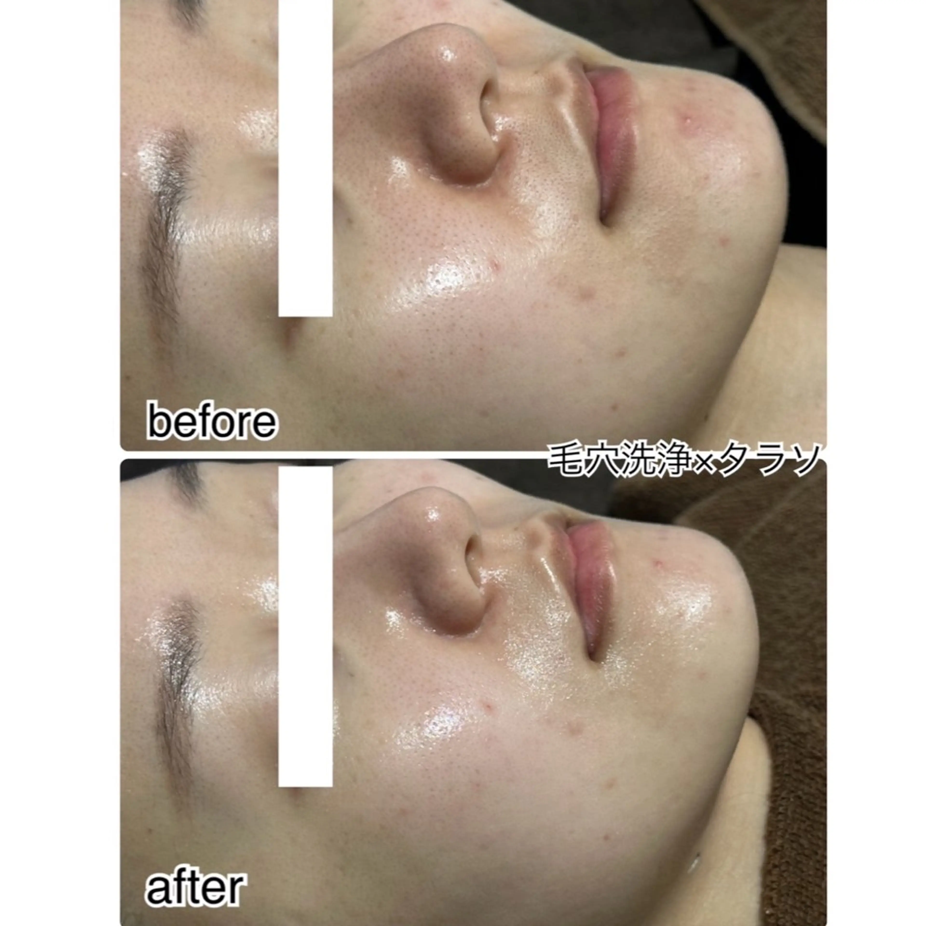 エステ kamie suzuneの眉毛・アイブロウイメージ