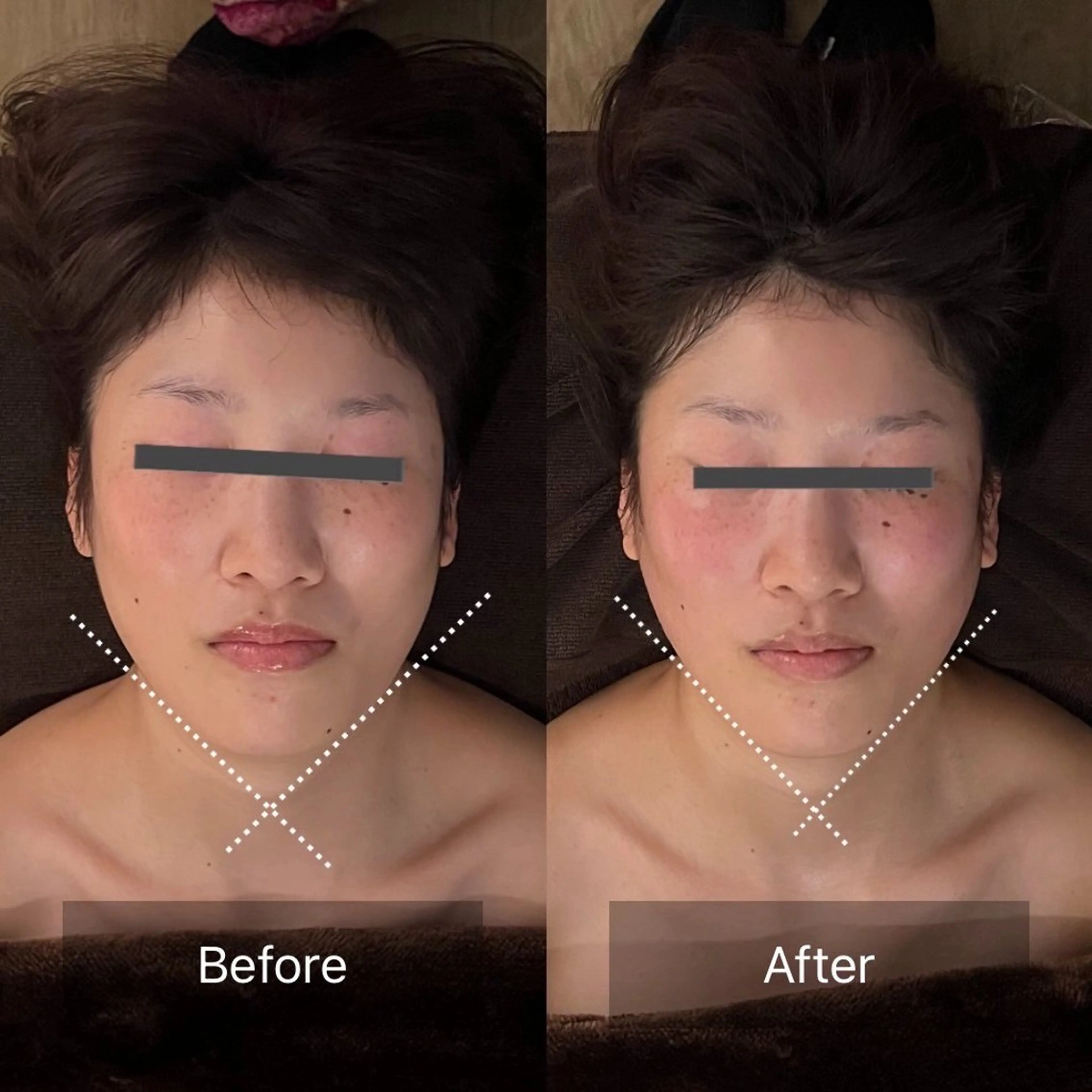 ニキビ･毛穴悩み特化 /CHISATOのエステ・リラクイメージ