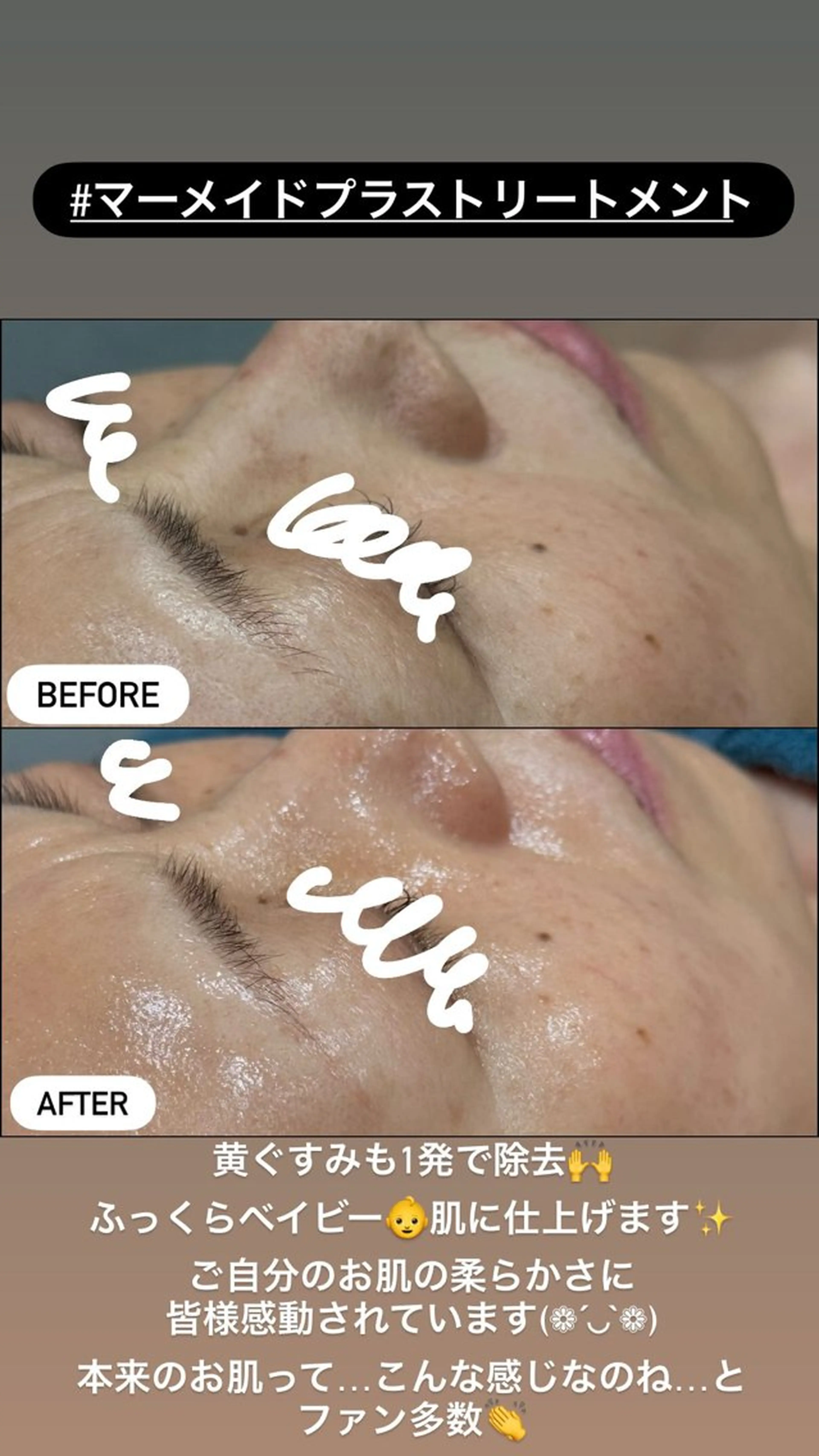 エステ LiZA エステティックサロンのエステ・リラクイメージ