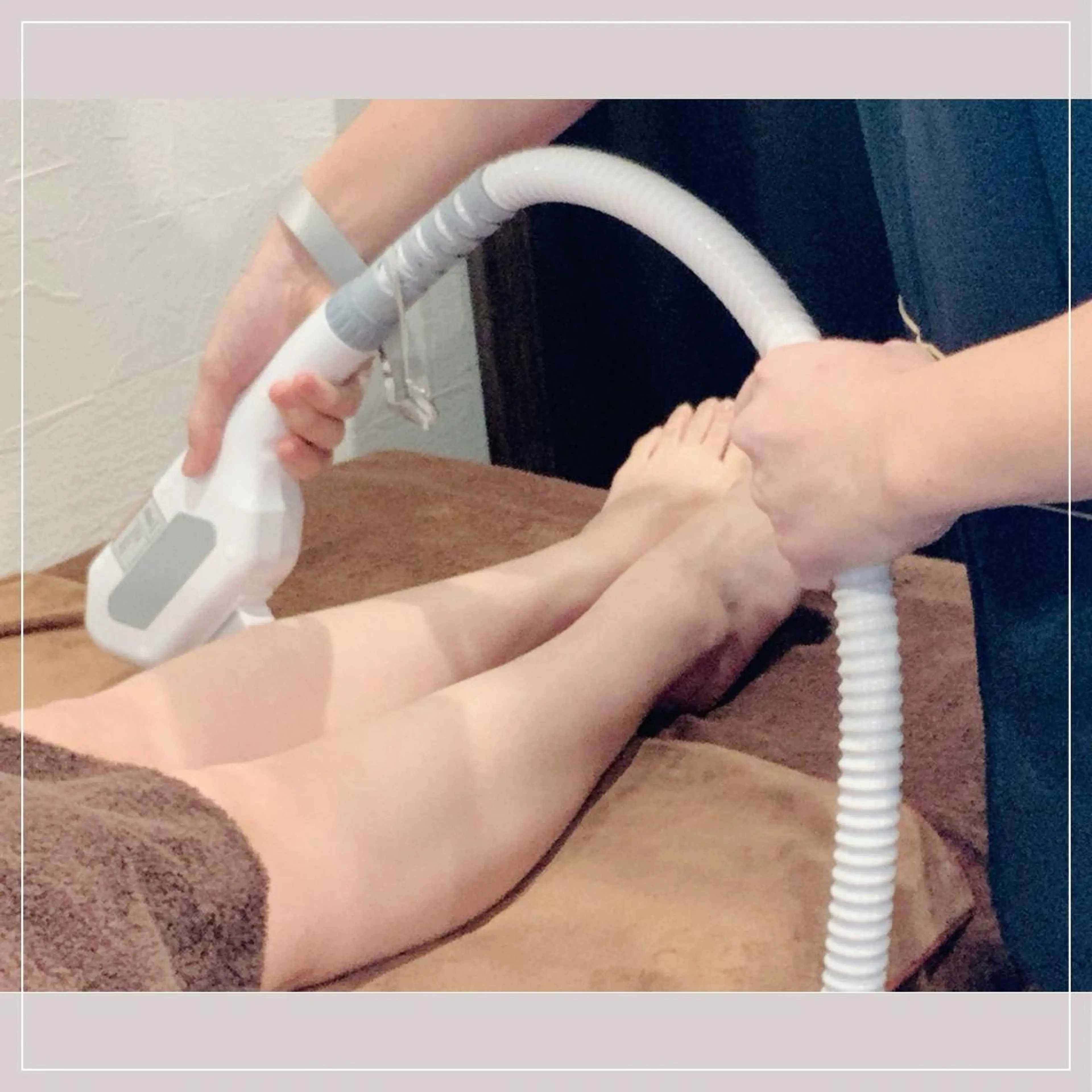 レディース足脱毛（太もも＋ひざ下）の写真