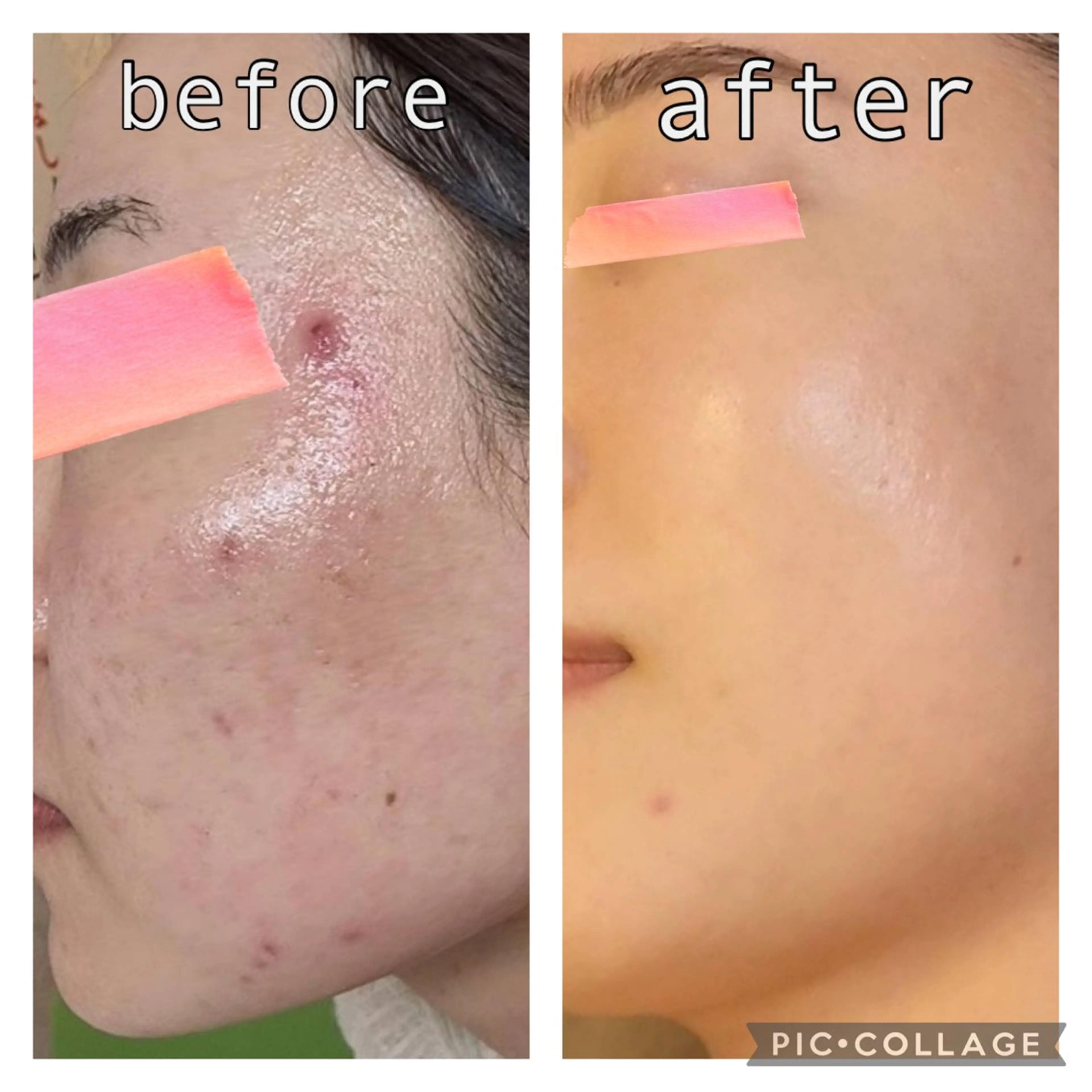 エステ ニキビ改善専門店 d'Albaのエステ・リラクイメージ