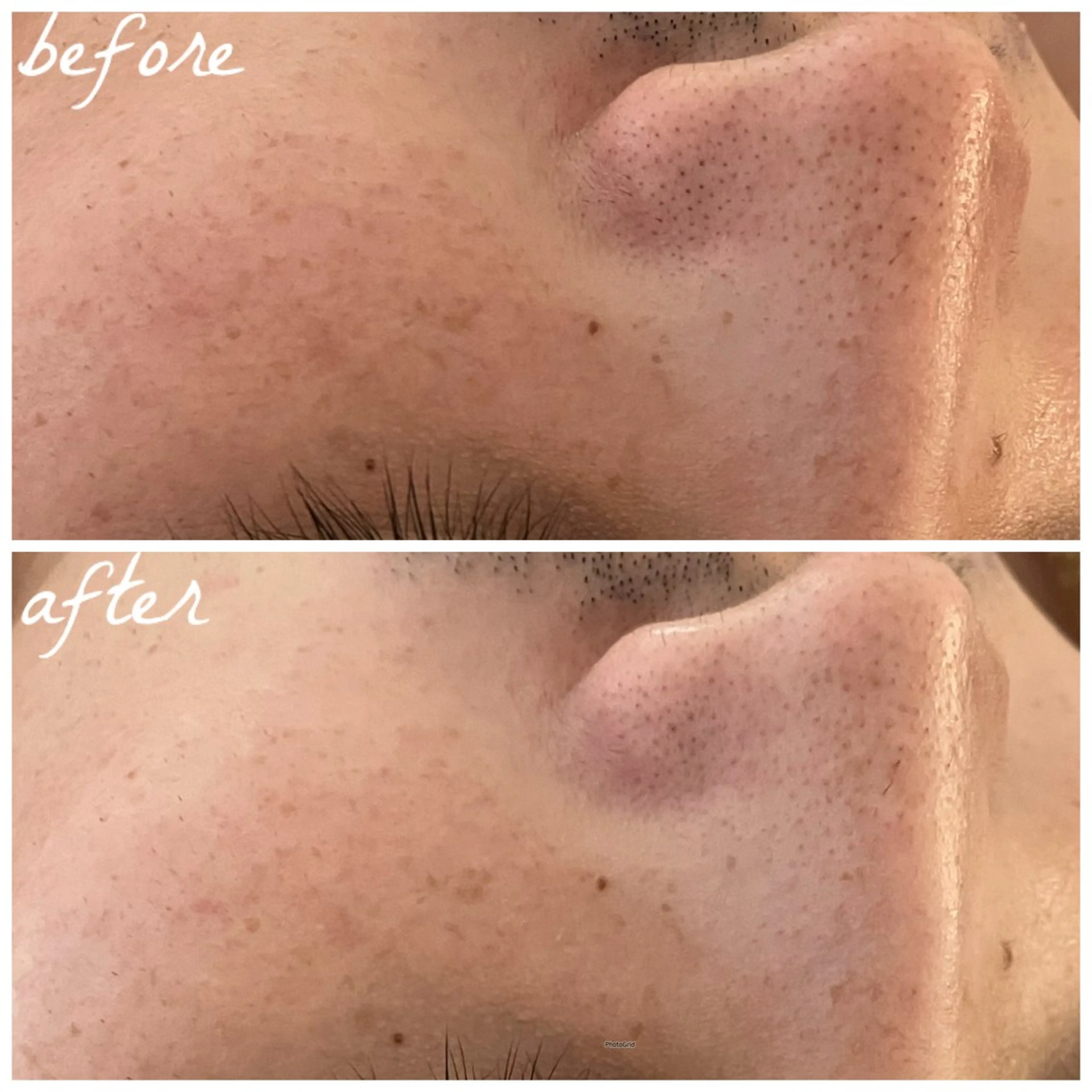 メンズ エステ メナード岐阜茜部 杉浦のエステ・リラクイメージ