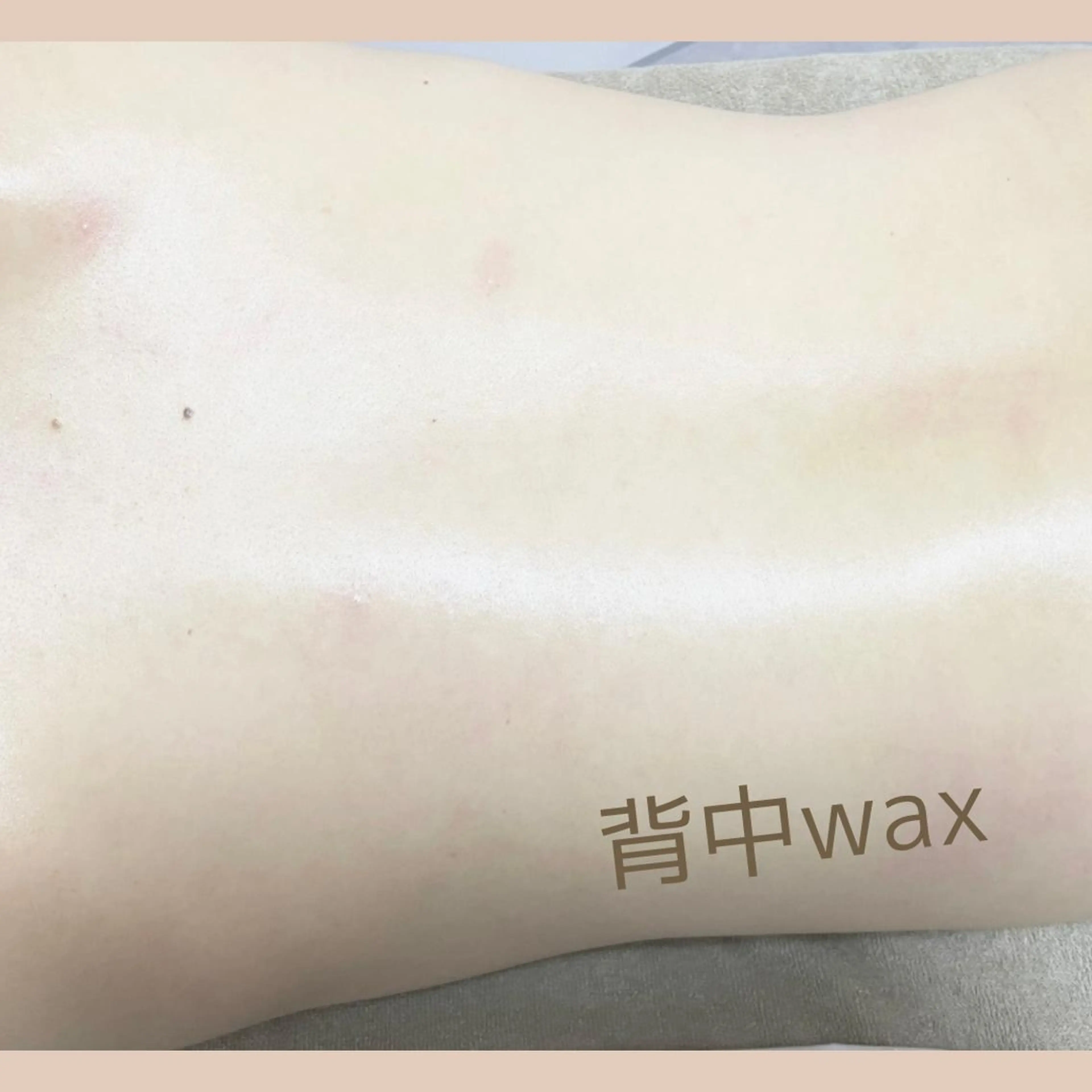 脱毛 &me ayakaのエステ・リラクイメージ