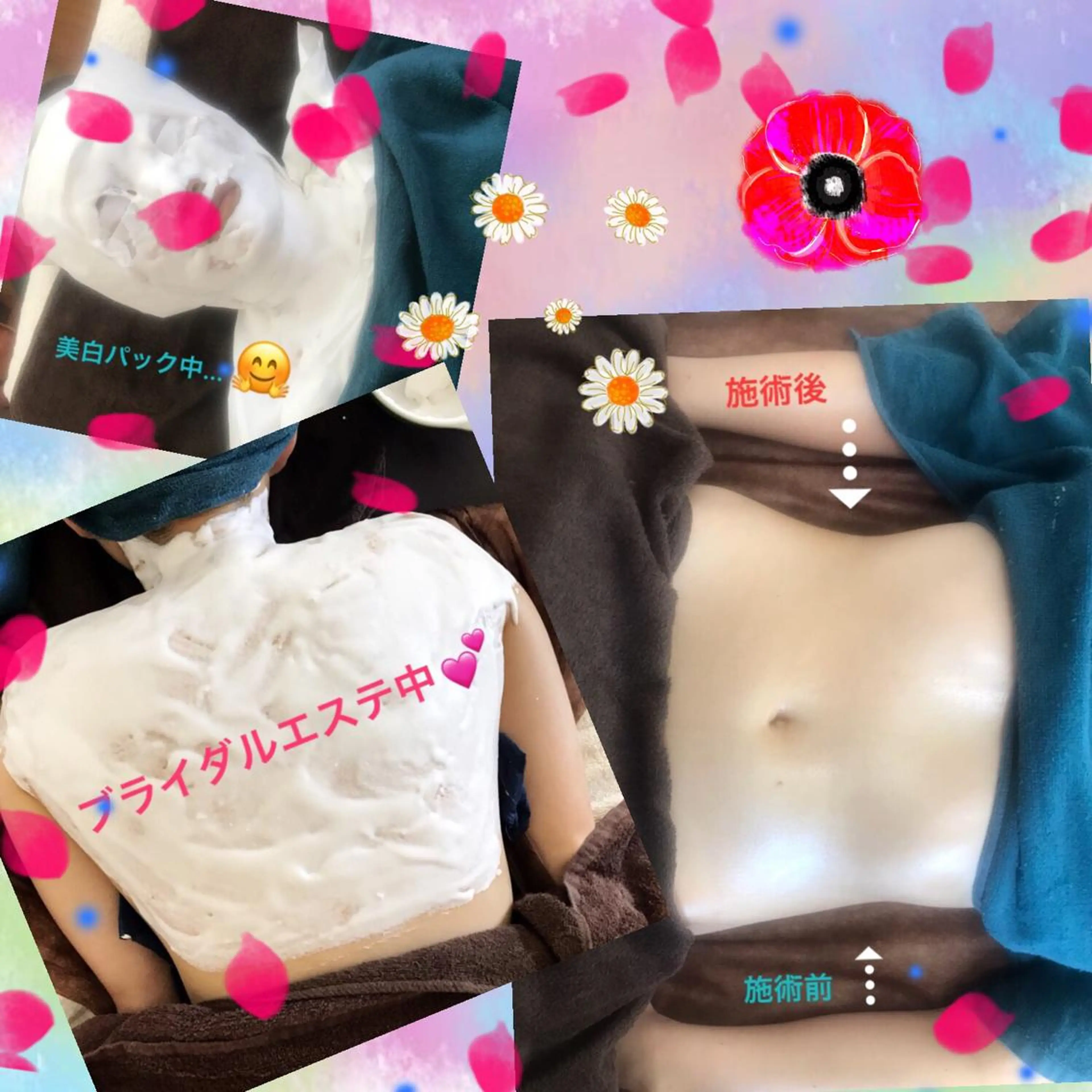 ブライダルエステ♡上半身コース160分の写真