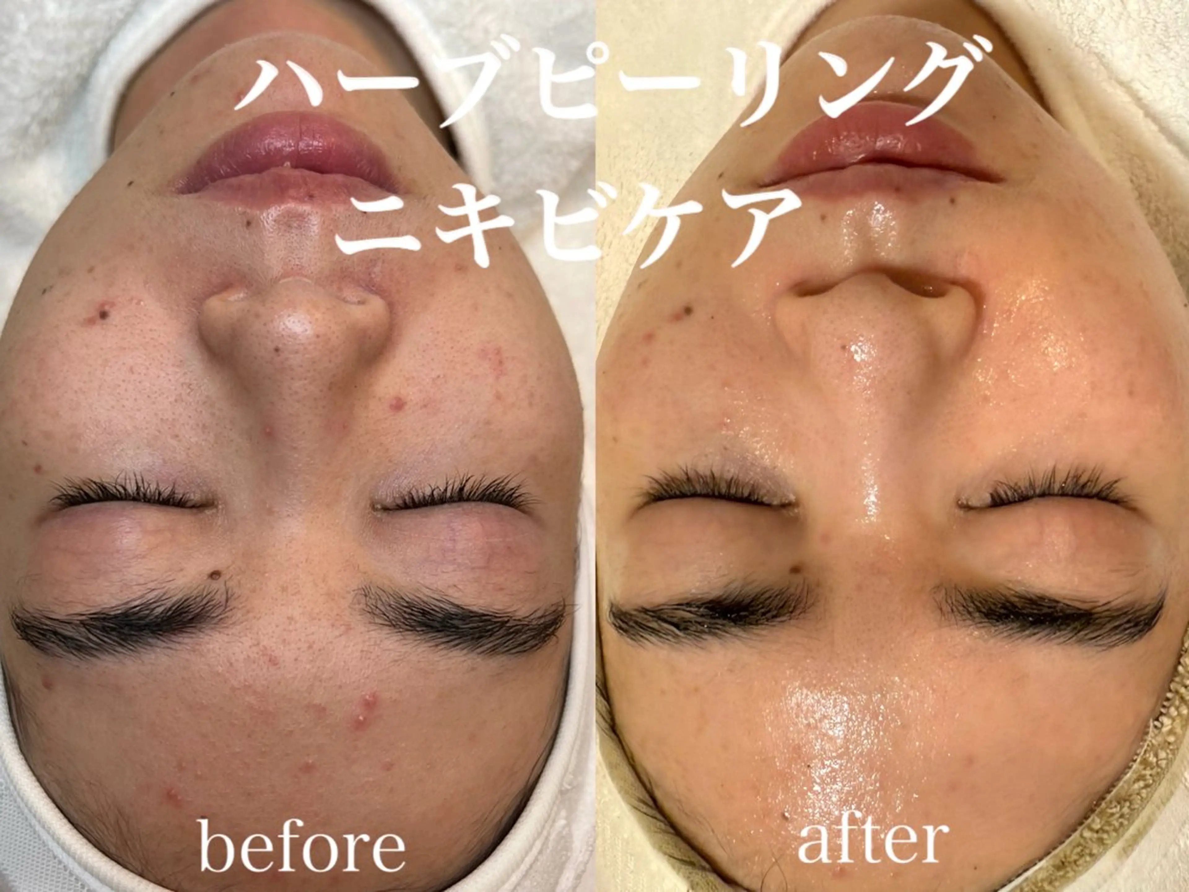 肌管理サロン neoriiのその他イメージ