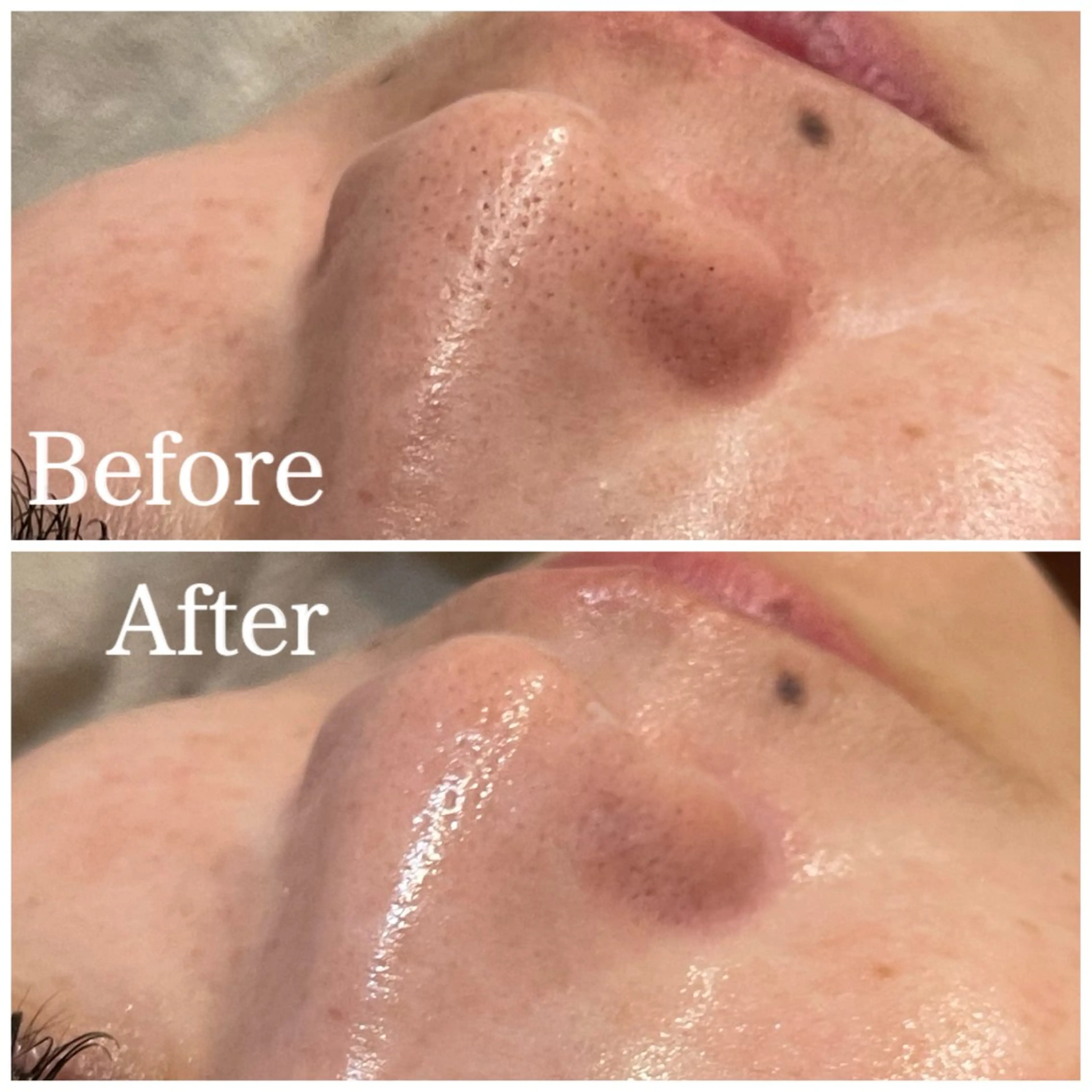 Nna Salon所属・Nna 🫧韓国肌管理🫧のエステ・リラクイメージ