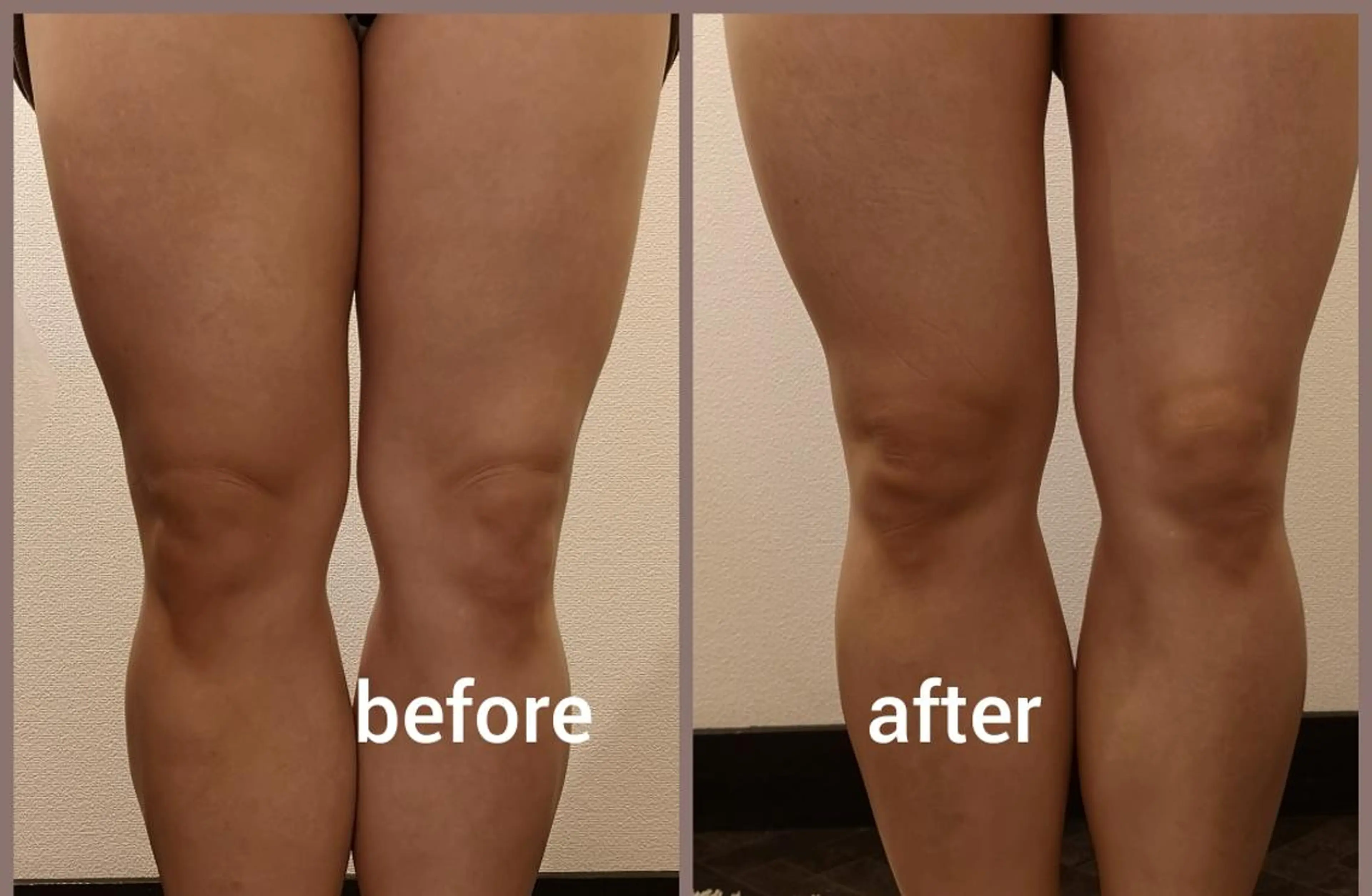 🅖🅤🅩🅔🅛 salonのエステ・リラクイメージ