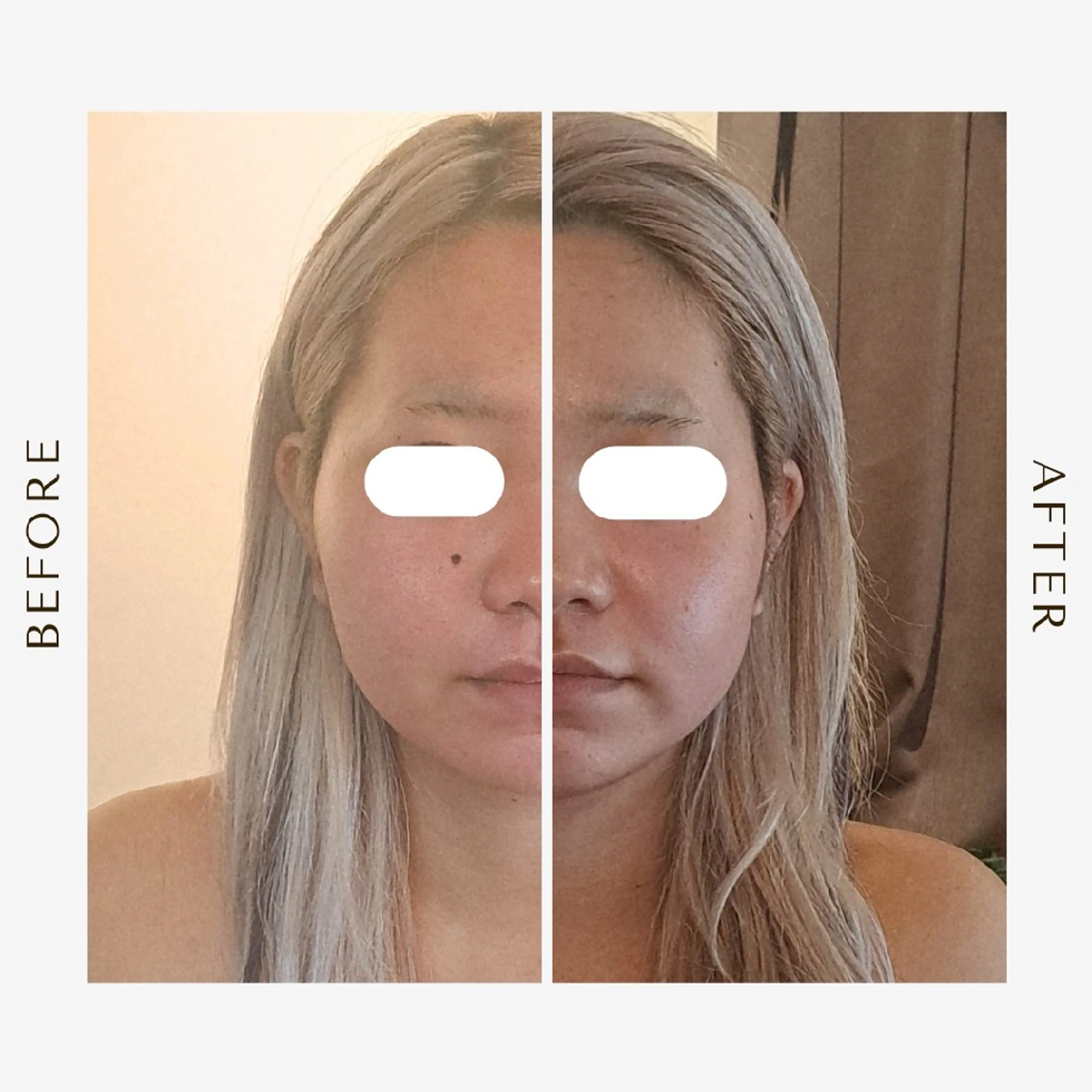 鍼灸サロンmiyabi所属・美容鍼×エステ 鍼灸 サロンmiyabiのエステ・リラクイメージ