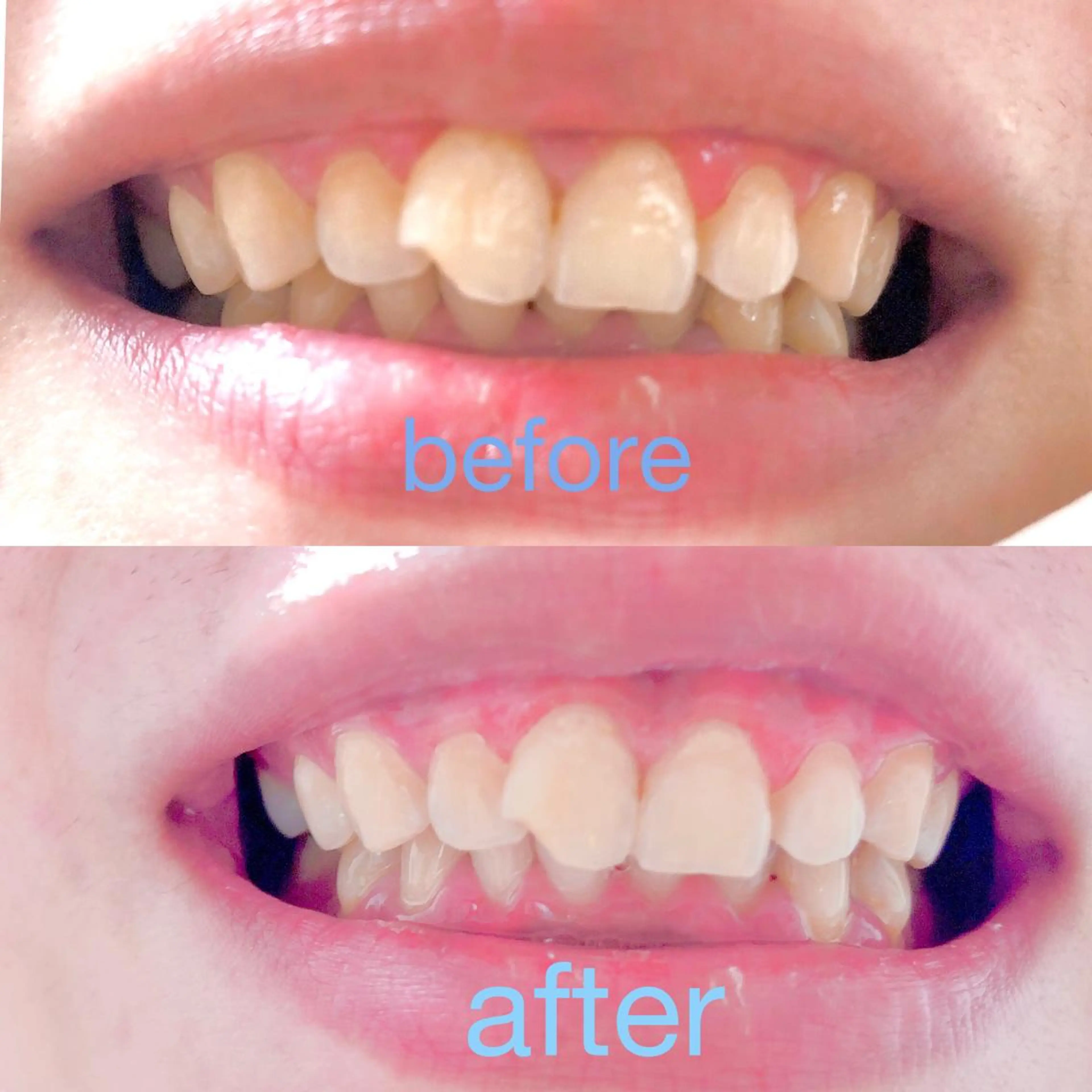 その他 two nailのネイルデザイン