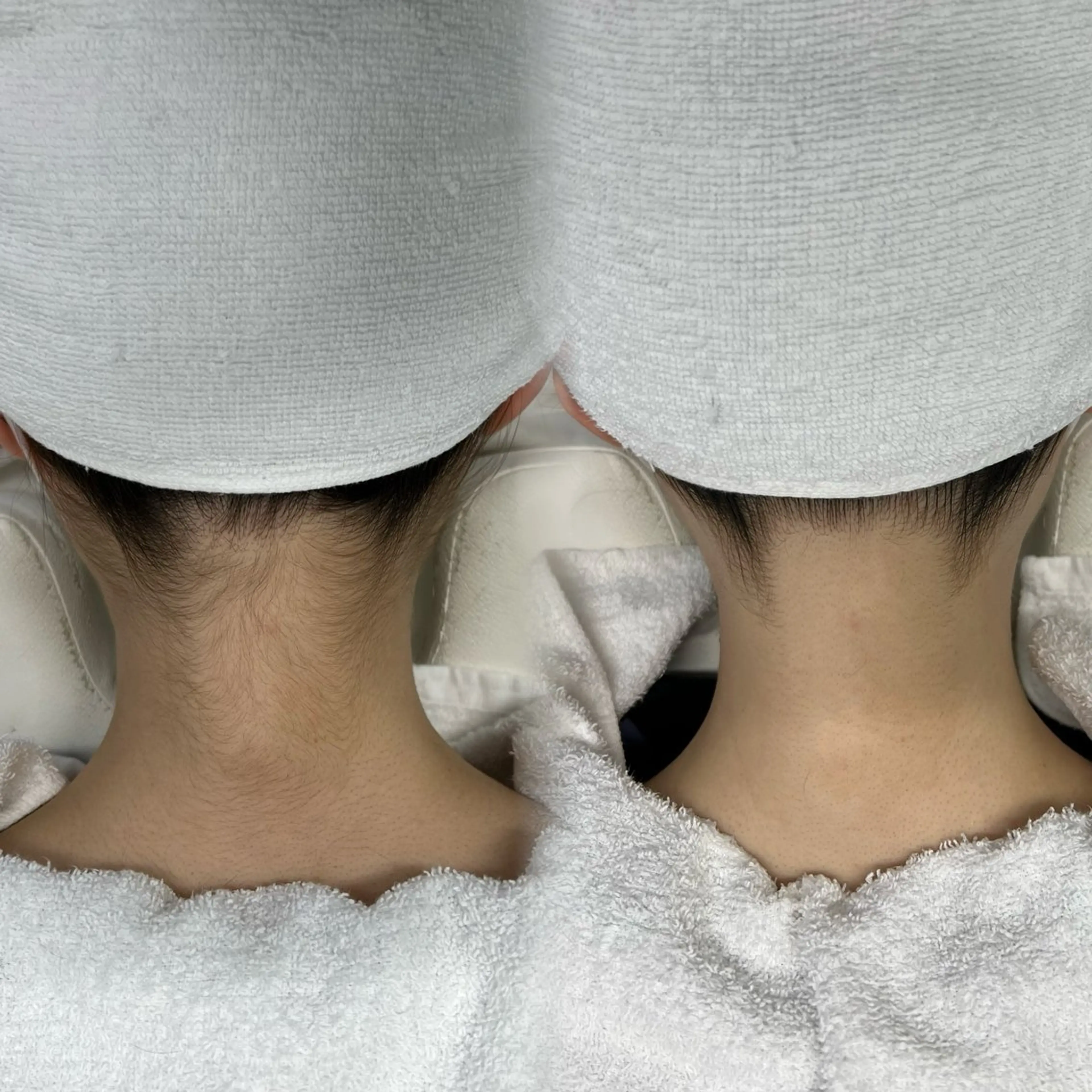 脱毛 けいこ꙳✧˖° 脱毛のエステ・リラクイメージ