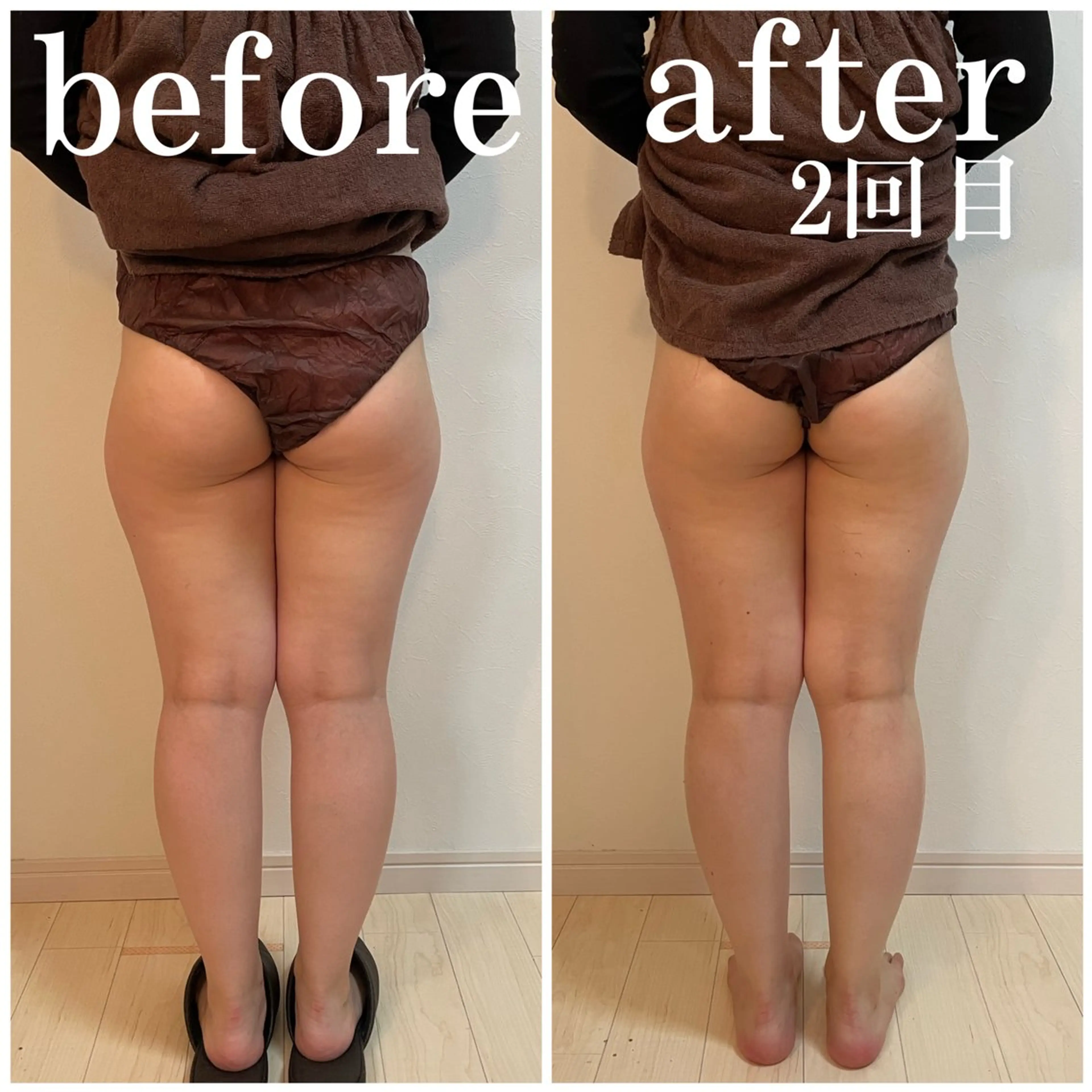 BeauL銀座 村浜友菜🤍のエステ・リラクイメージ