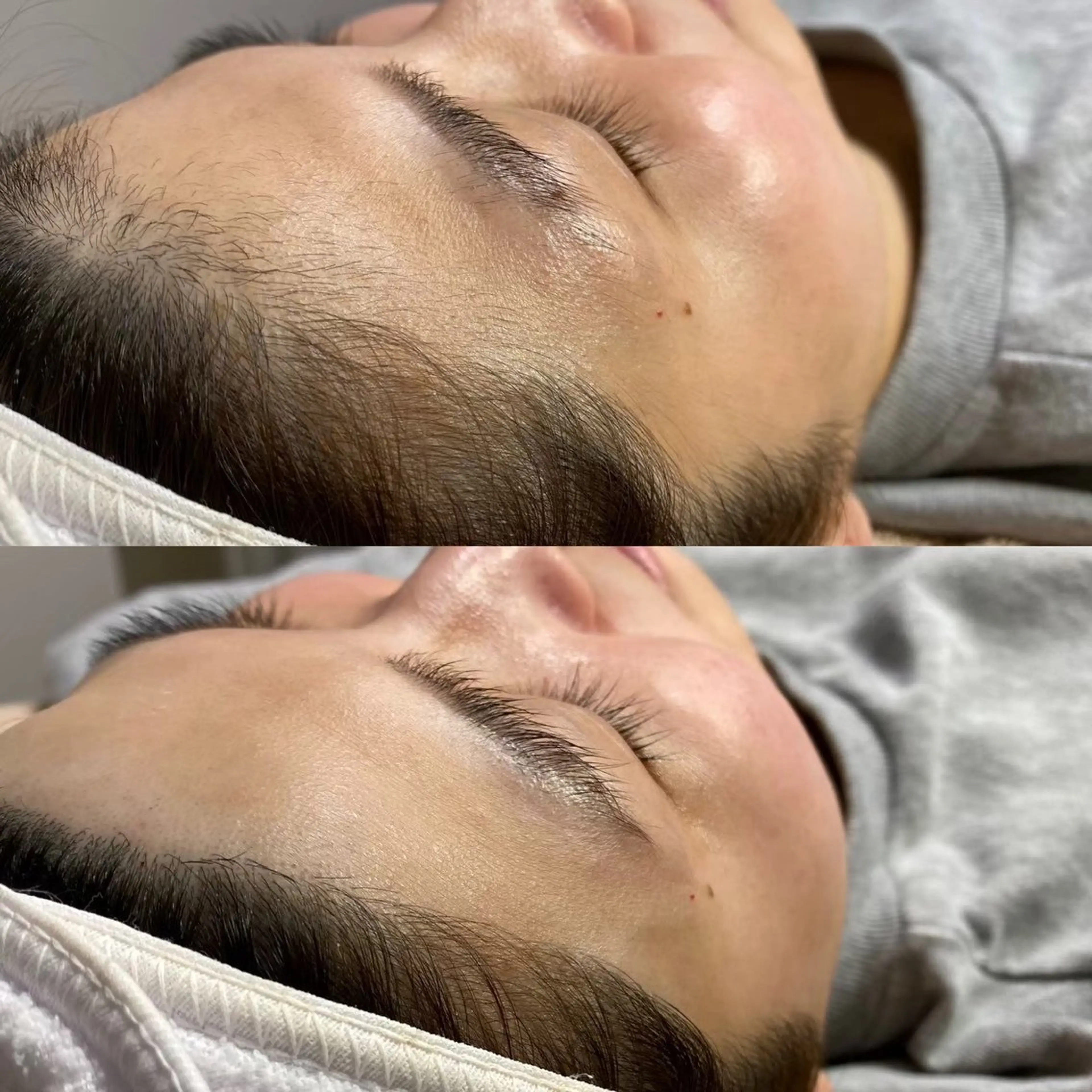 脱毛 脱毛サロンBloom所属・脱毛屋さん/池袋 /Bloom🍋わだのエステ・リラクイメージ