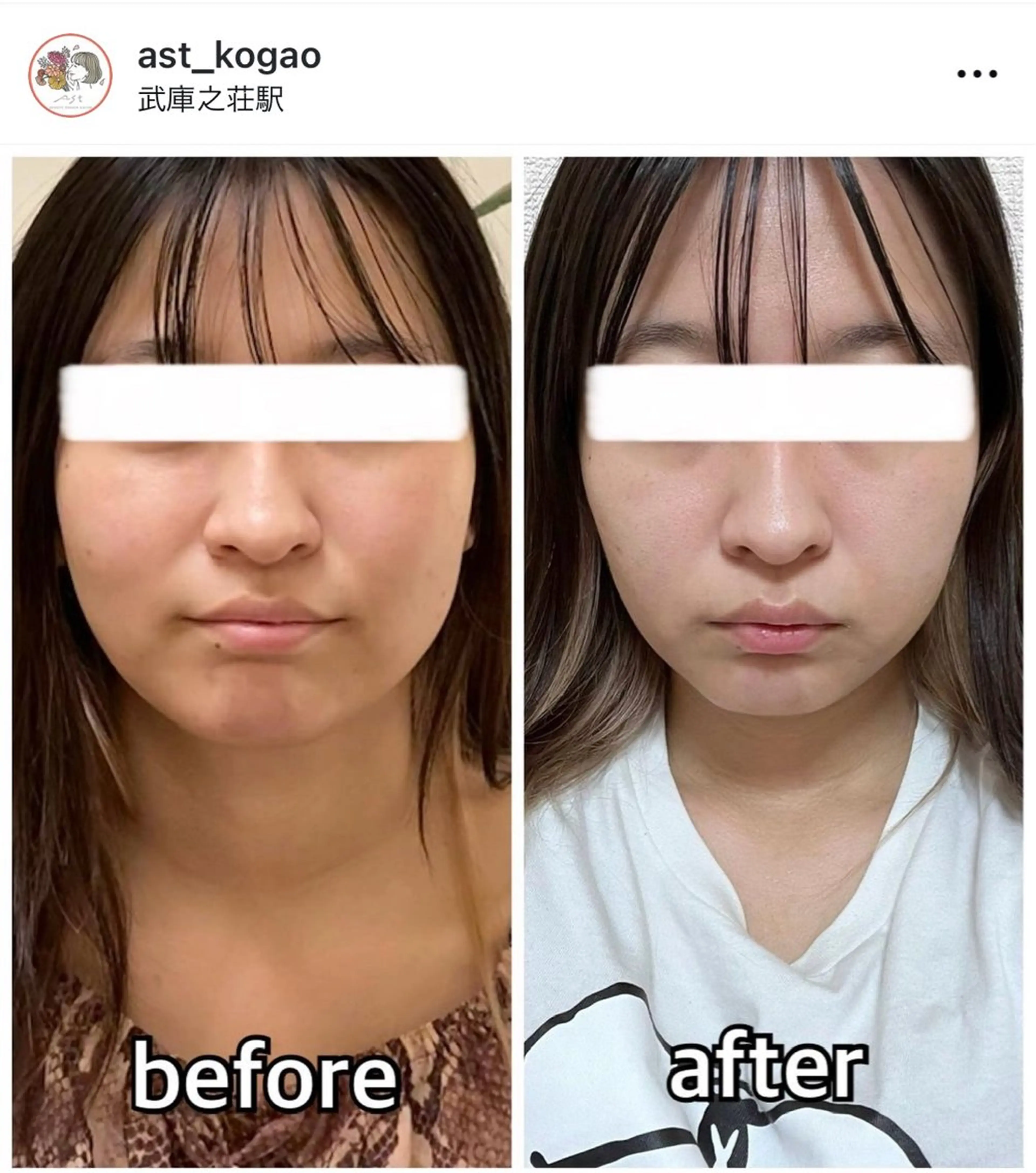 エステ リラク 小顔矯正サロンAST【アスト】所属・小顔矯正サロン AST【アスト】のその他イメージ