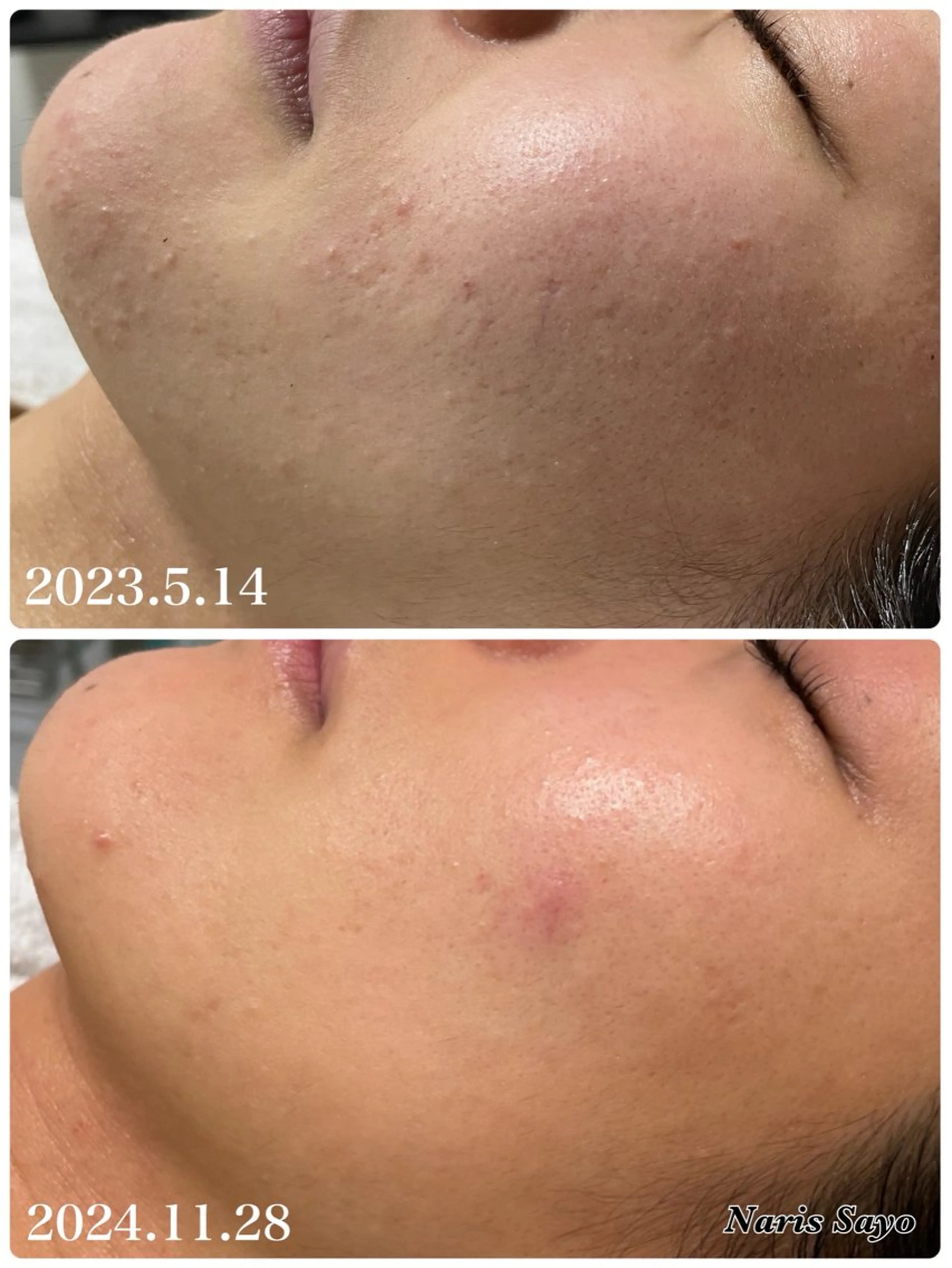 エステ デ・アイム豊中所属・朝山 紗世子のエステ・リラクイメージ