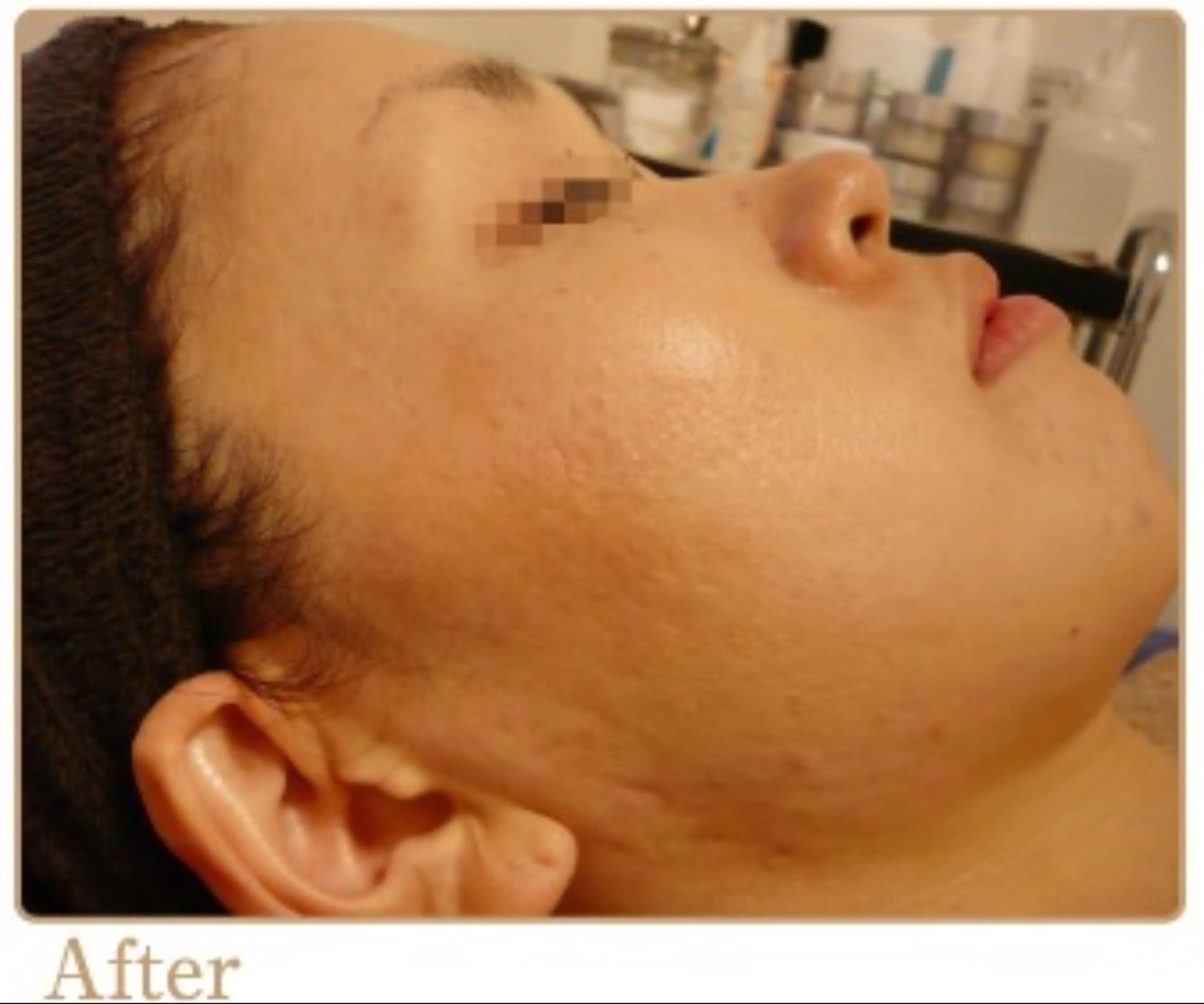 ピーリングサロン シャンテールのエステ・リラクイメージ