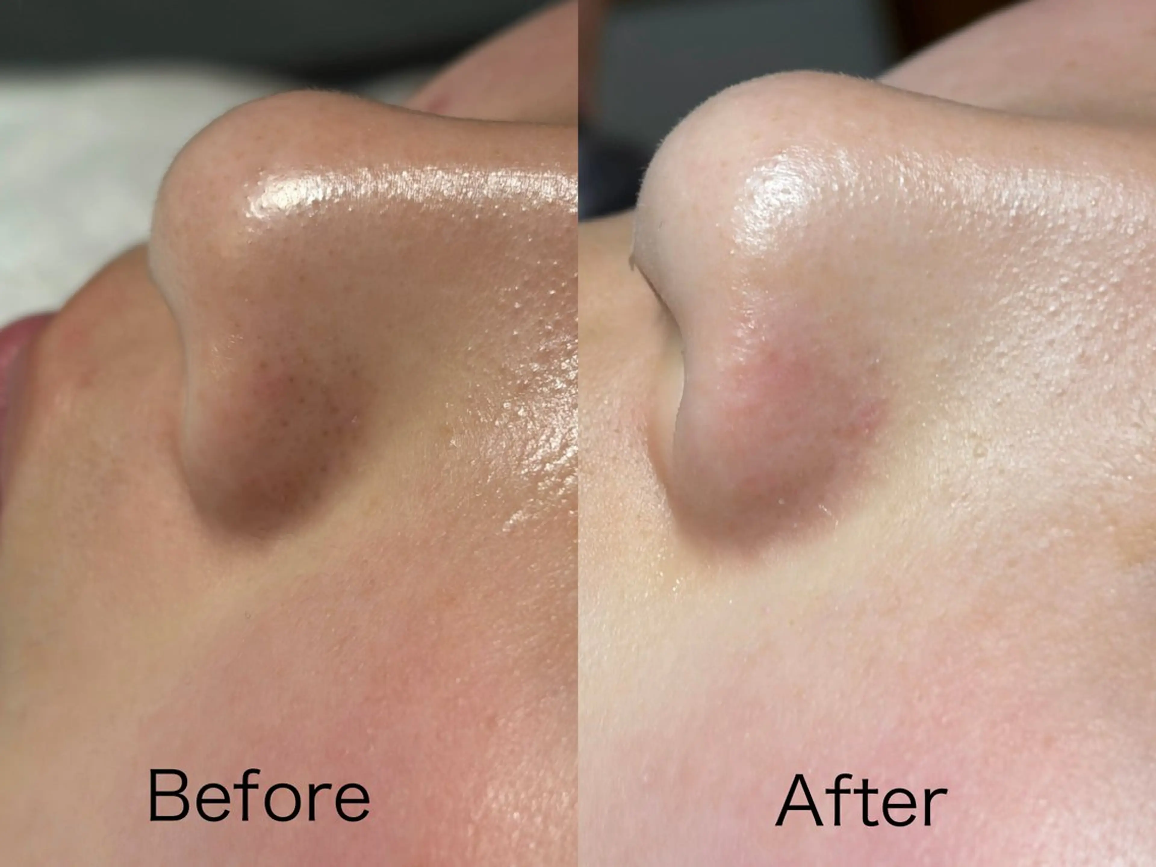 エステ MIKI ミキのエステ・リラクイメージ