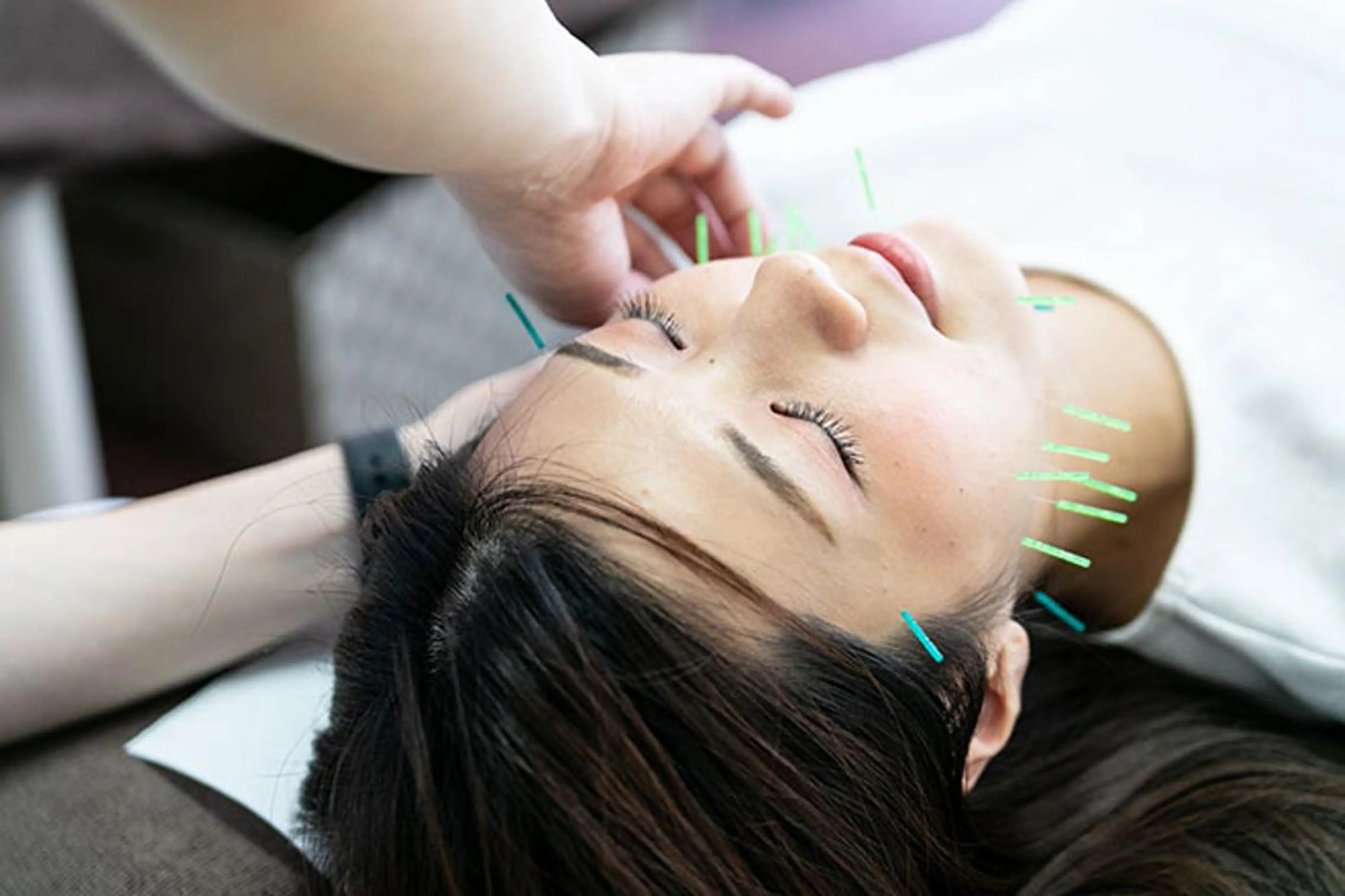 同心整骨院 美容鍼・整体・小顔のエステ・リラクイメージ