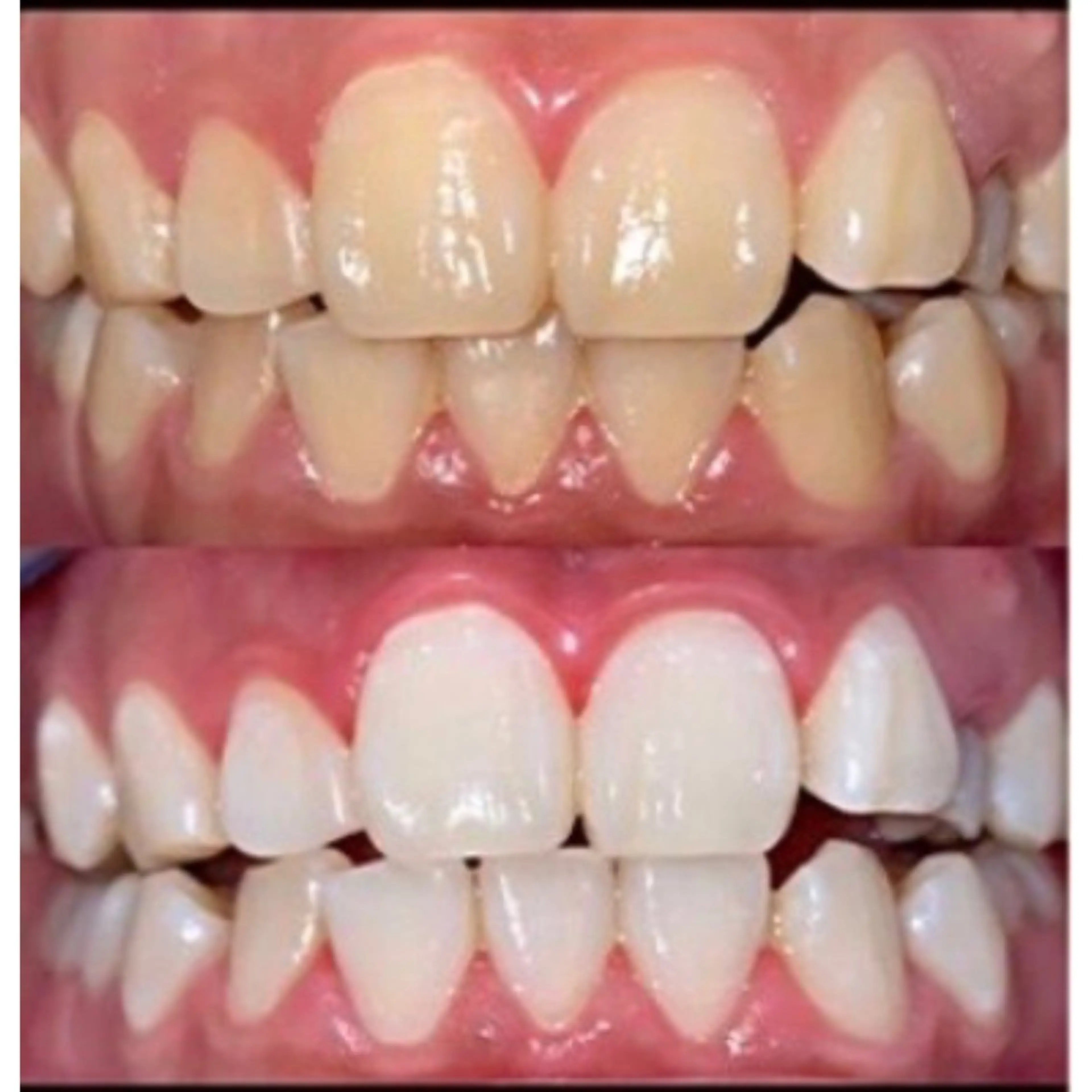 エステ プラチナムビューティー柏所属・【歯科提携】柏ホワイ トニングスタイルのその他イメージ