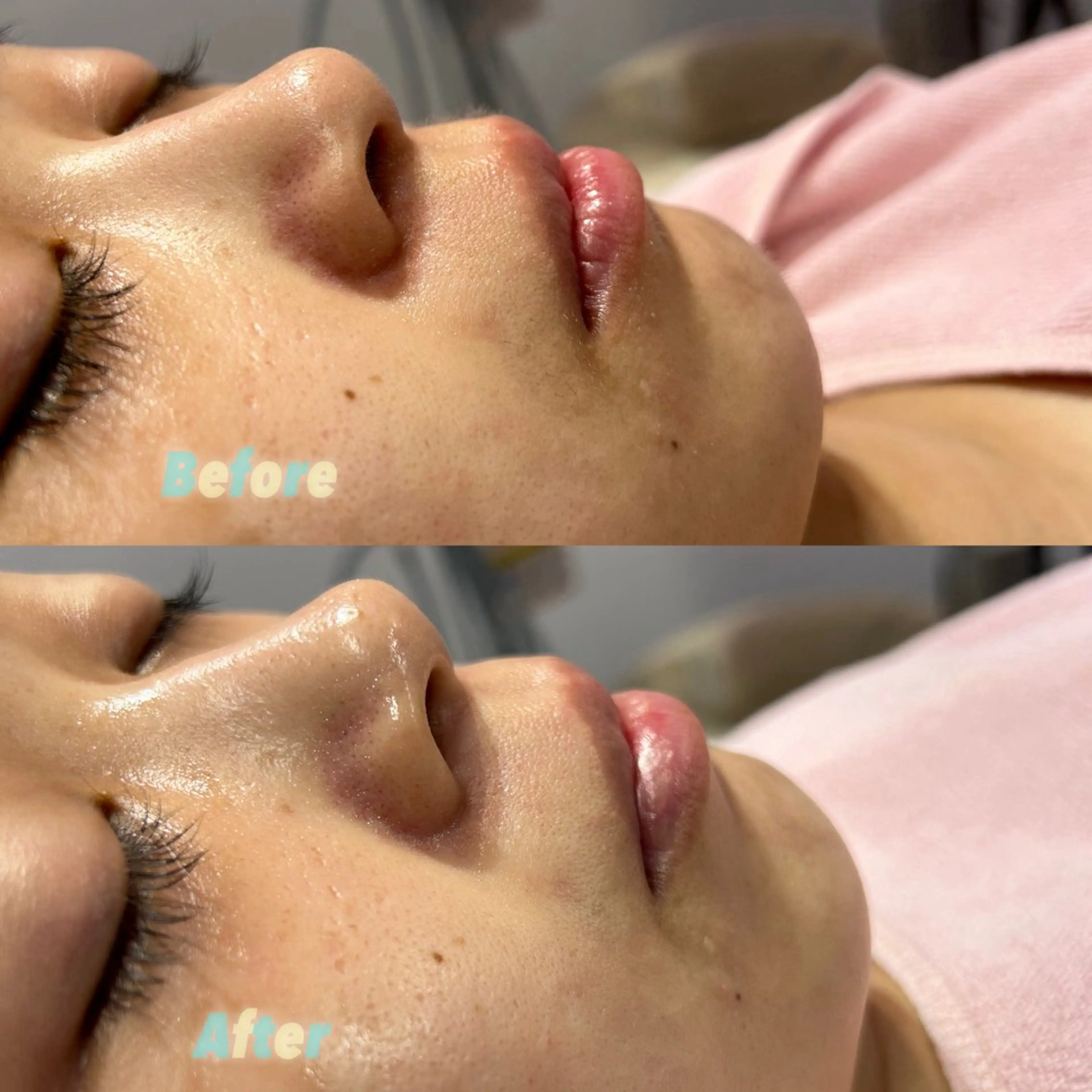 🫧美しい素肌へ🫧 今成柚乃のその他イメージ