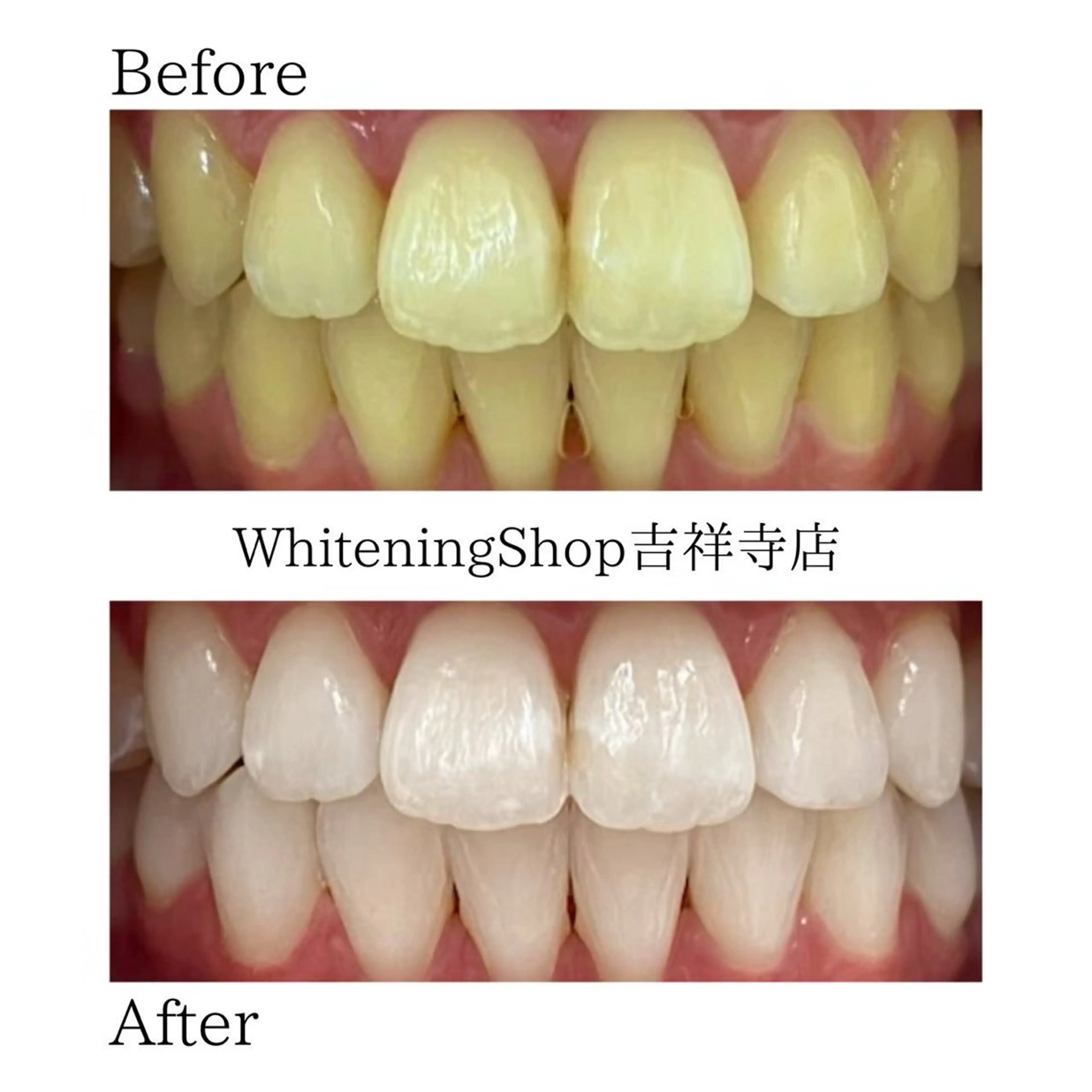 ホワイトニングショッ 吉祥寺2号店のエステ・リラクイメージ