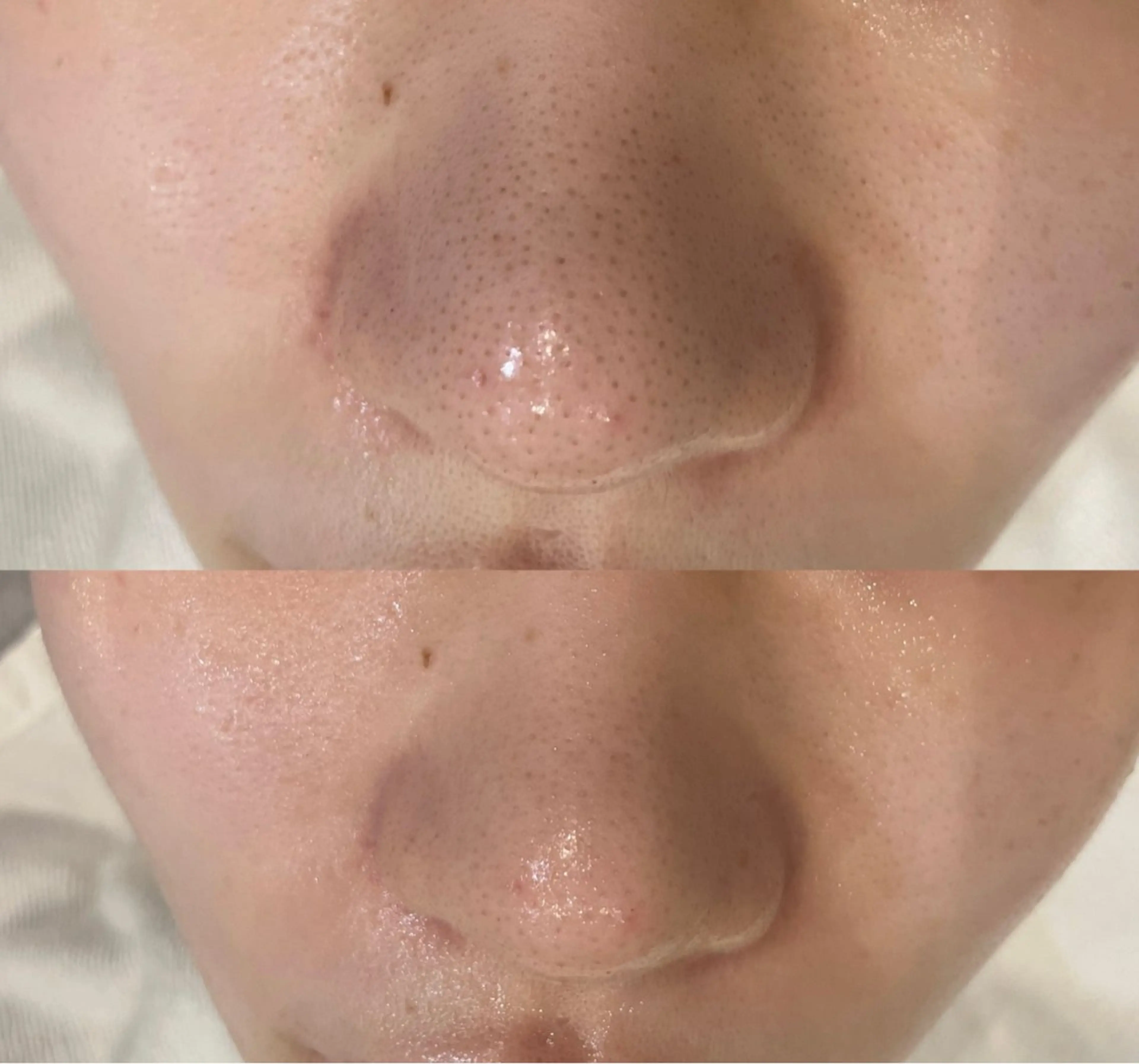 エステ DeI'm   名古屋栄所属・小林 玲菜のエステ・リラクイメージ