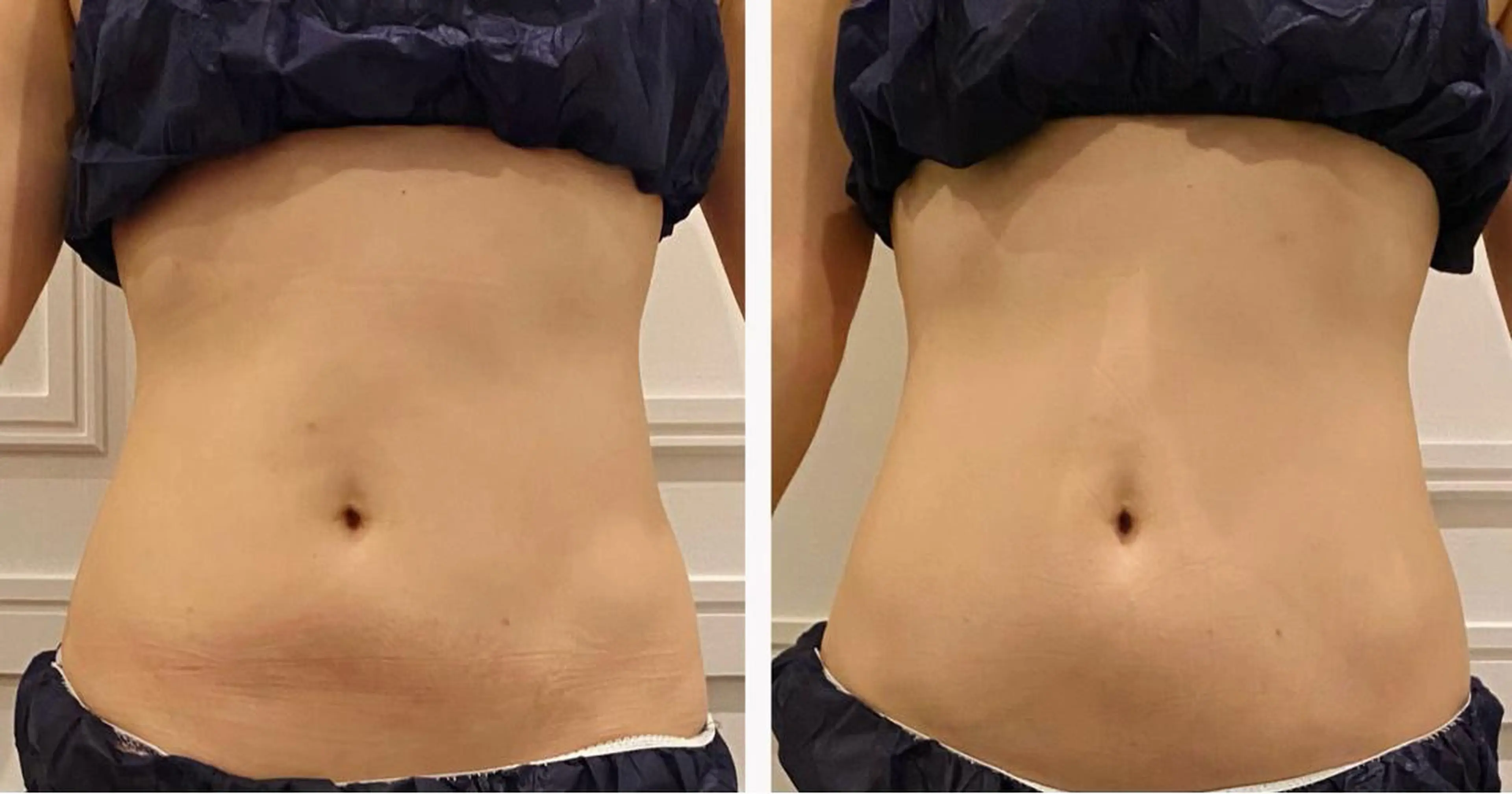 エステ リラク 通うほど変わる本格 エステ心斎橋REVIのエステ・リラクイメージ