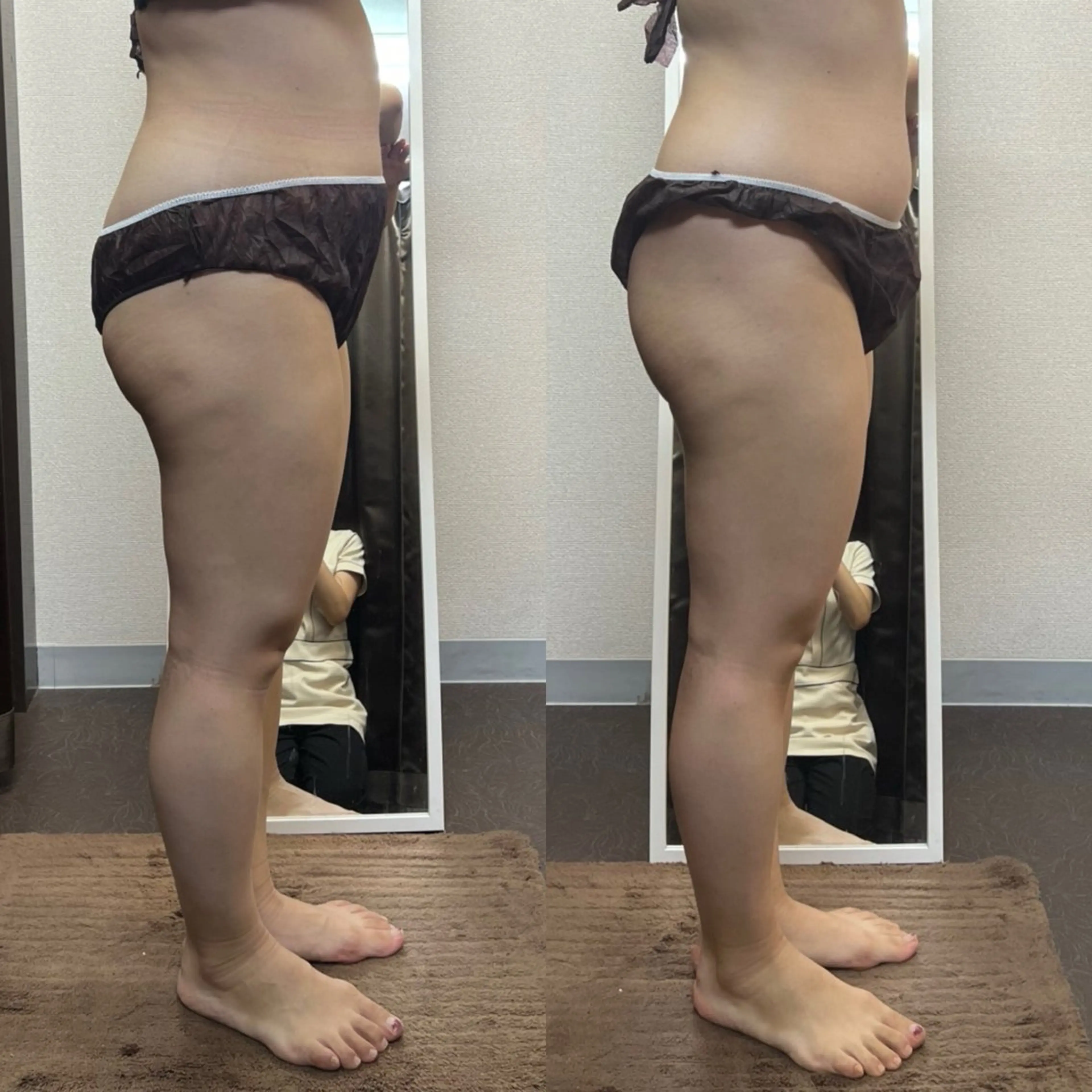 エステ ハイパーナイフ専門店　Salon de COCO所属・Salon de COCOのエステ・リラクイメージ