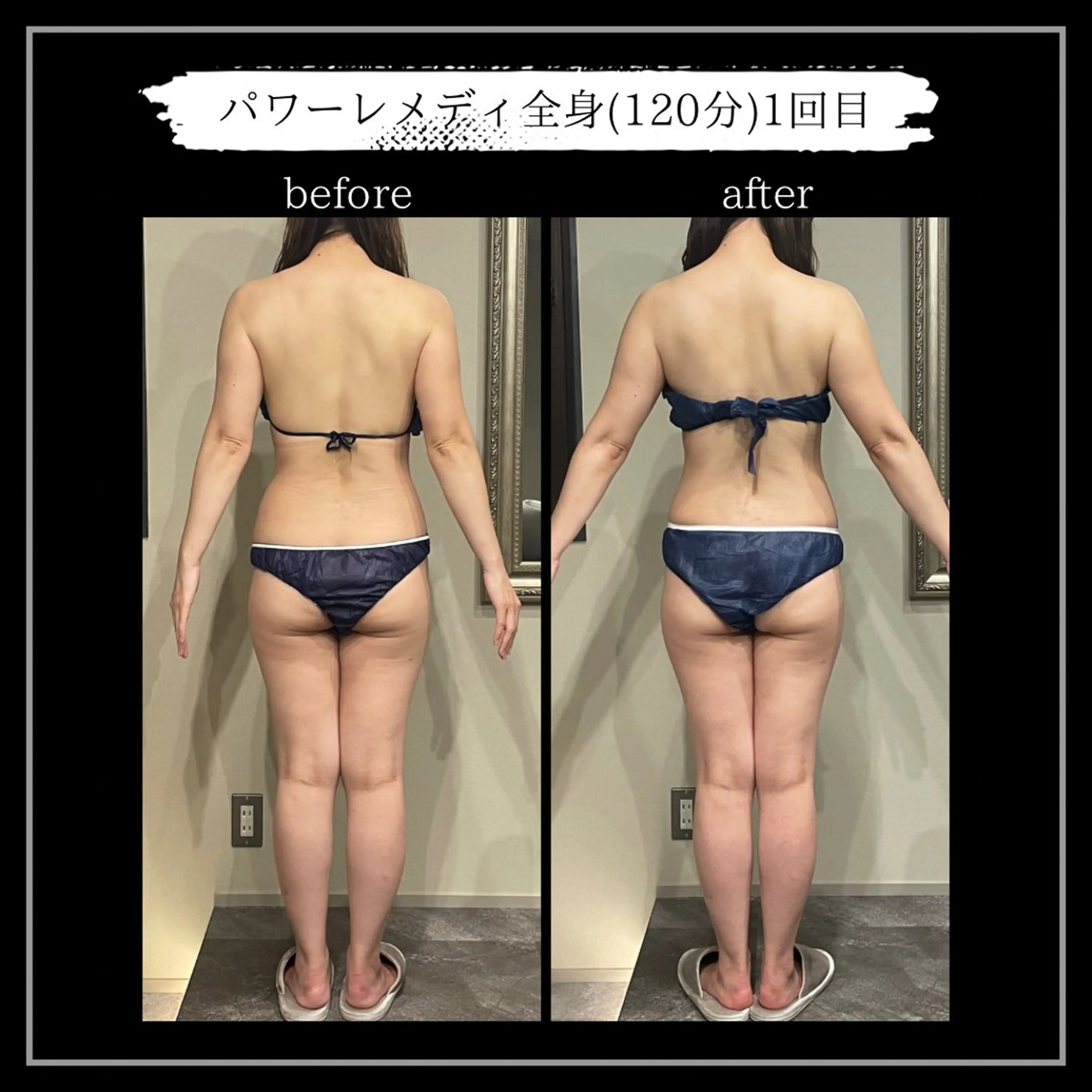 オフ:オン所属・オフ:オン 全身筋膜マッサージのエステ・リラクイメージ