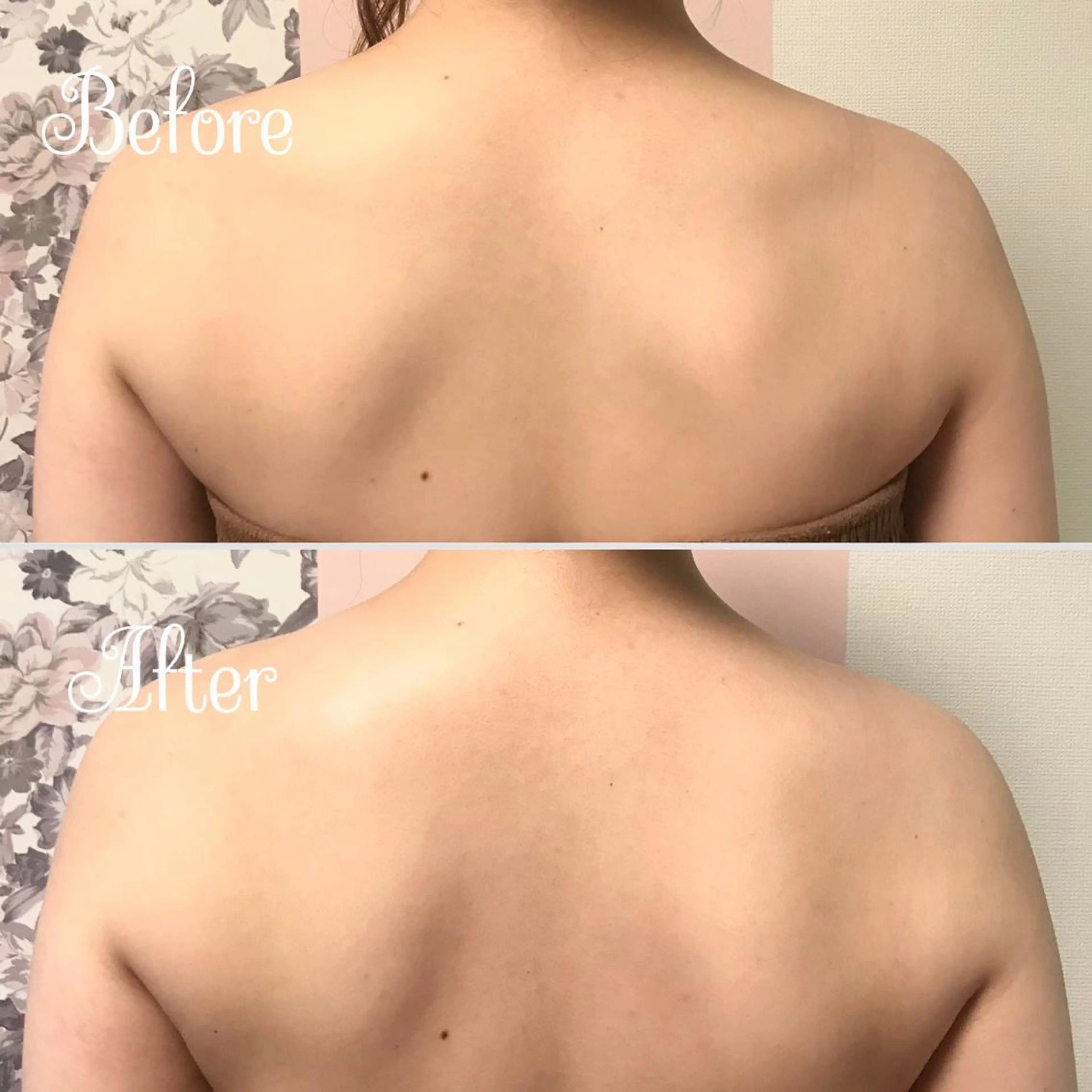 透明感の肌Lino malieのエステ・リラクイメージ