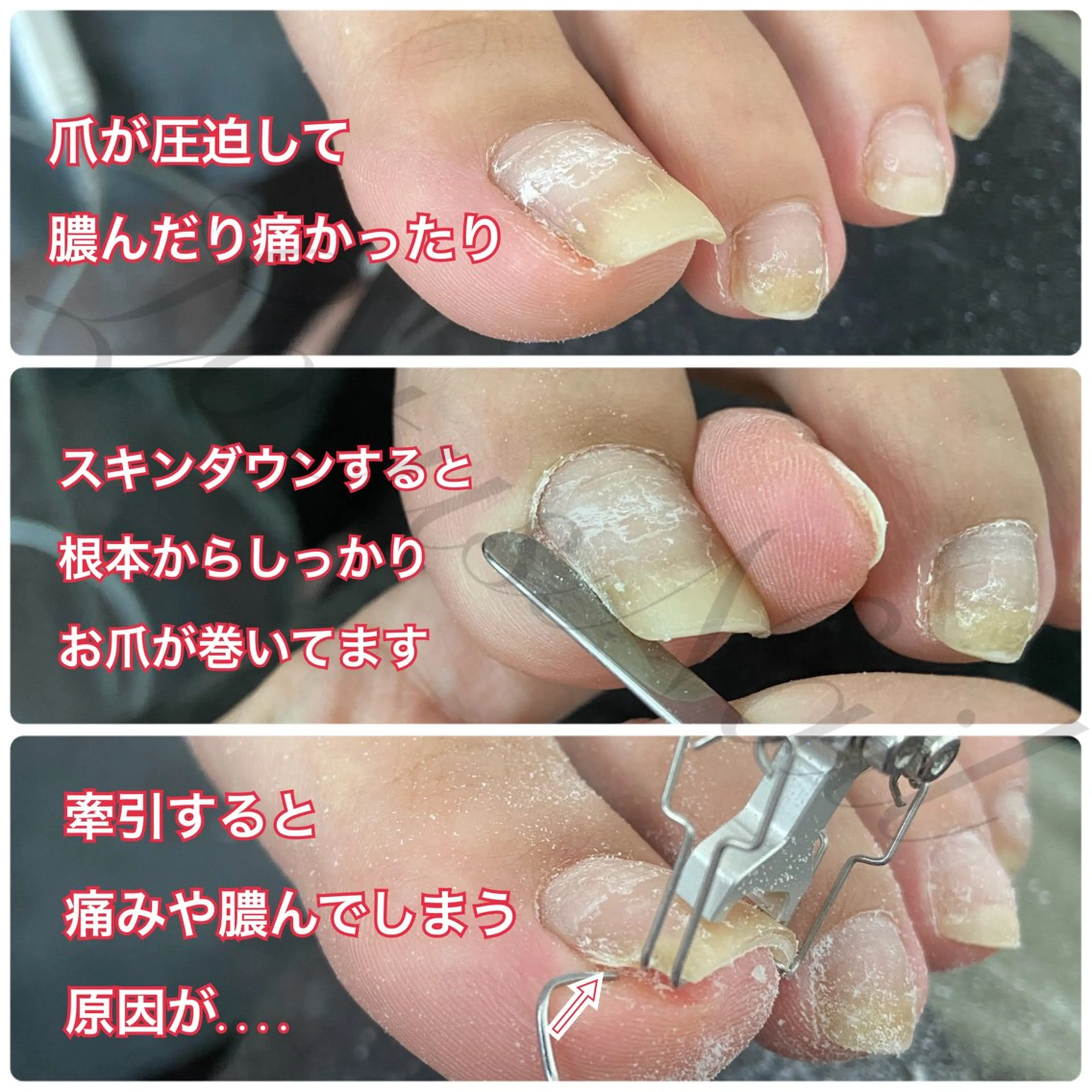 ネイル フットネイル フットネイル Lotus Nailのネイルデザイン