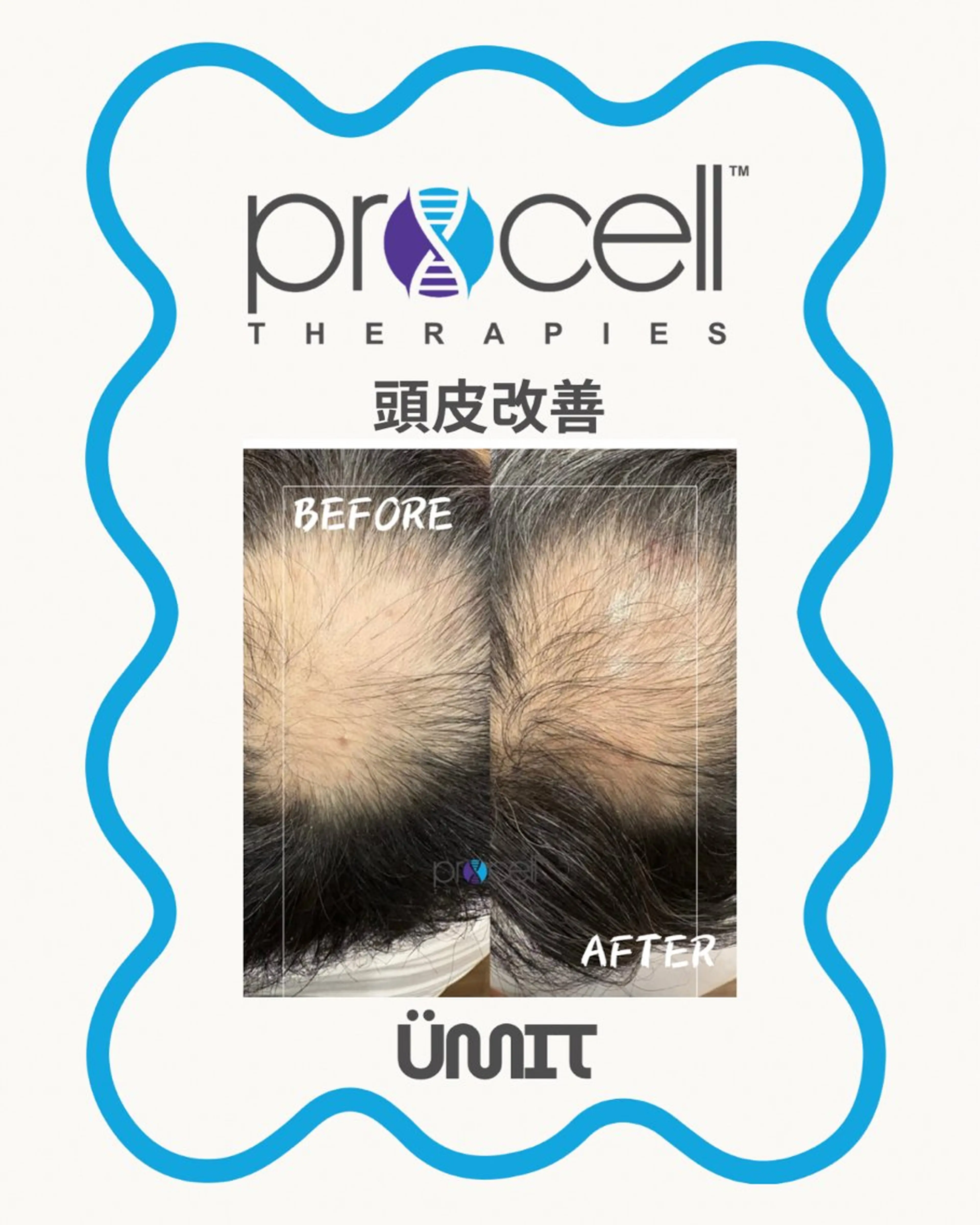 メンズ ヘッドスパ Ümit（ユミト） プロセルセラピーズのヘアスタイル