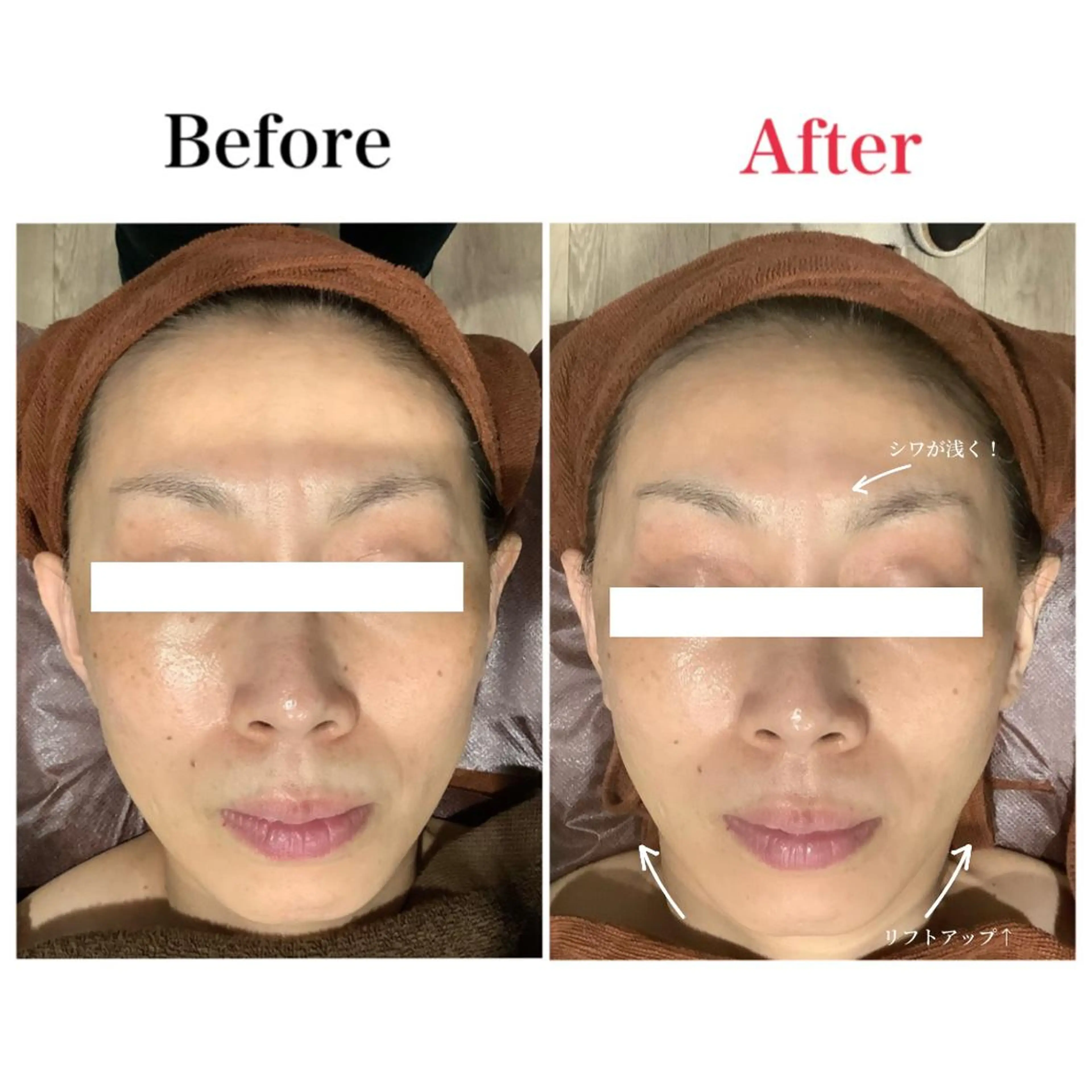 サロンボーテアネラ燕三条所属・サロンボーテアネラ 燕三条のエステ・リラクイメージ