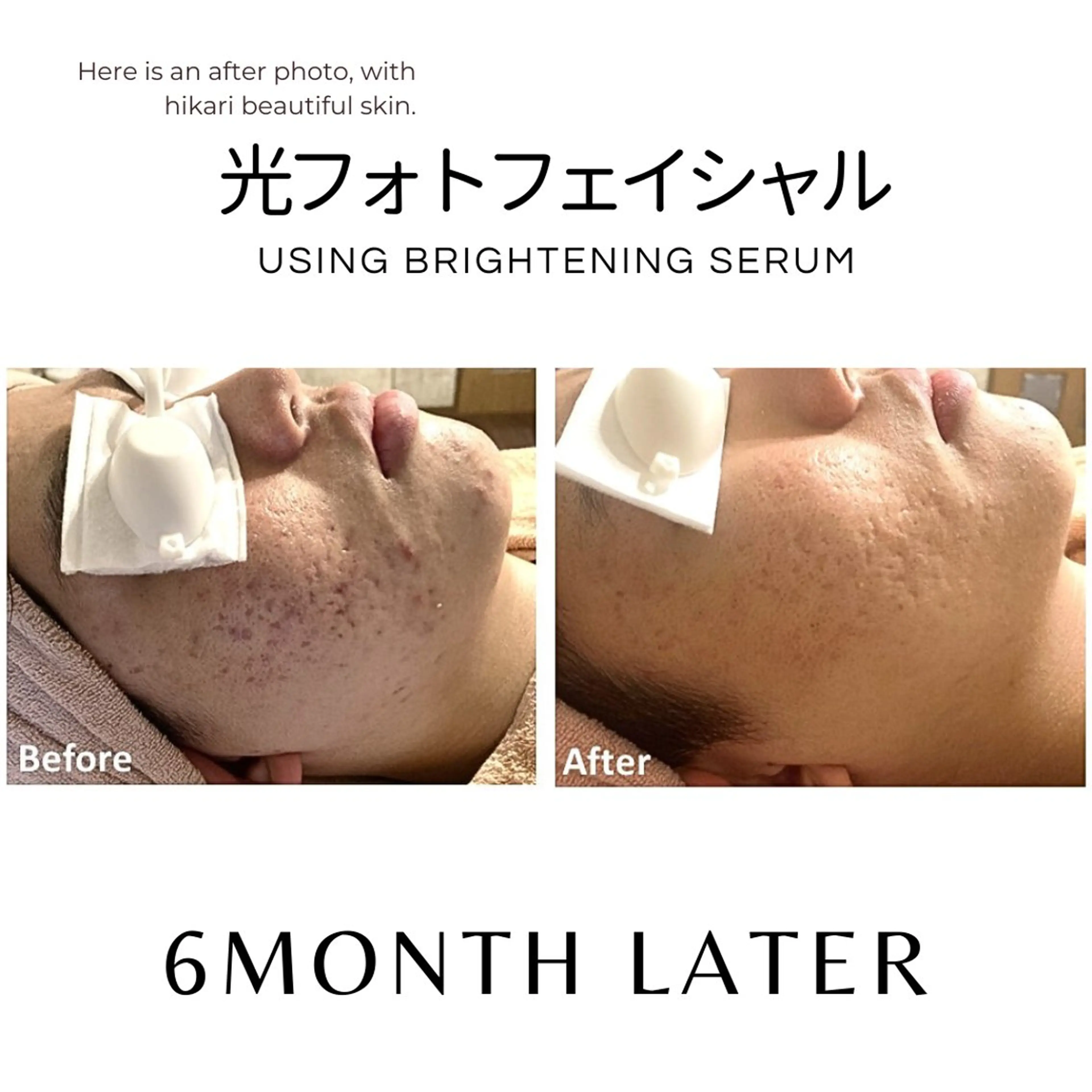 脱毛サロン　HUGME.所属・脱毛サロンHUGME 光フォトフェイシャルのエステ・リラクイメージ