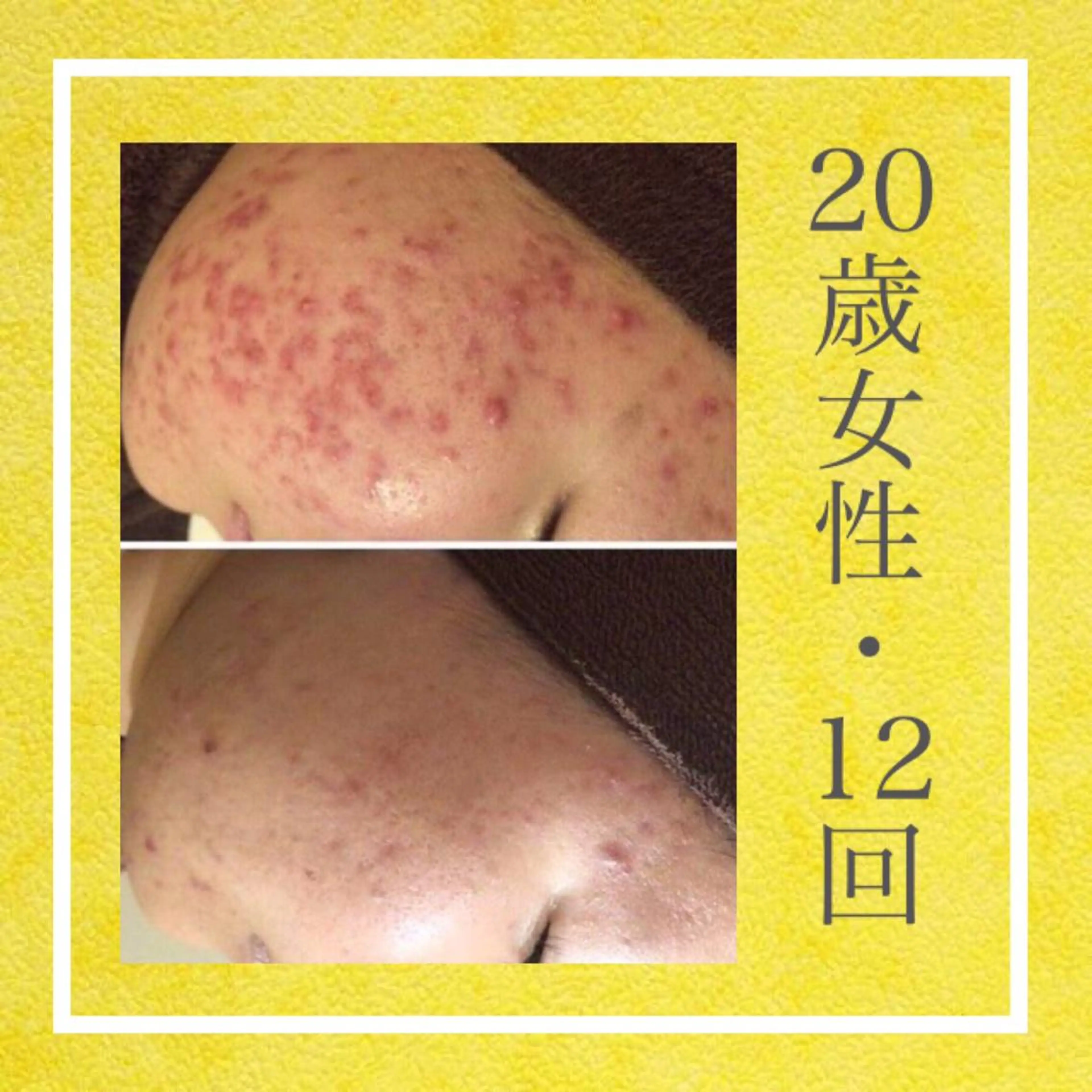 ミディアム カラー パーマ ヘアアレンジ メンズ キッズ ネイル マツエク・マツパ エステ リラク ニキビ・肌質改善専門 ♡人生が変わるサロンのエステ・リラクイメージ