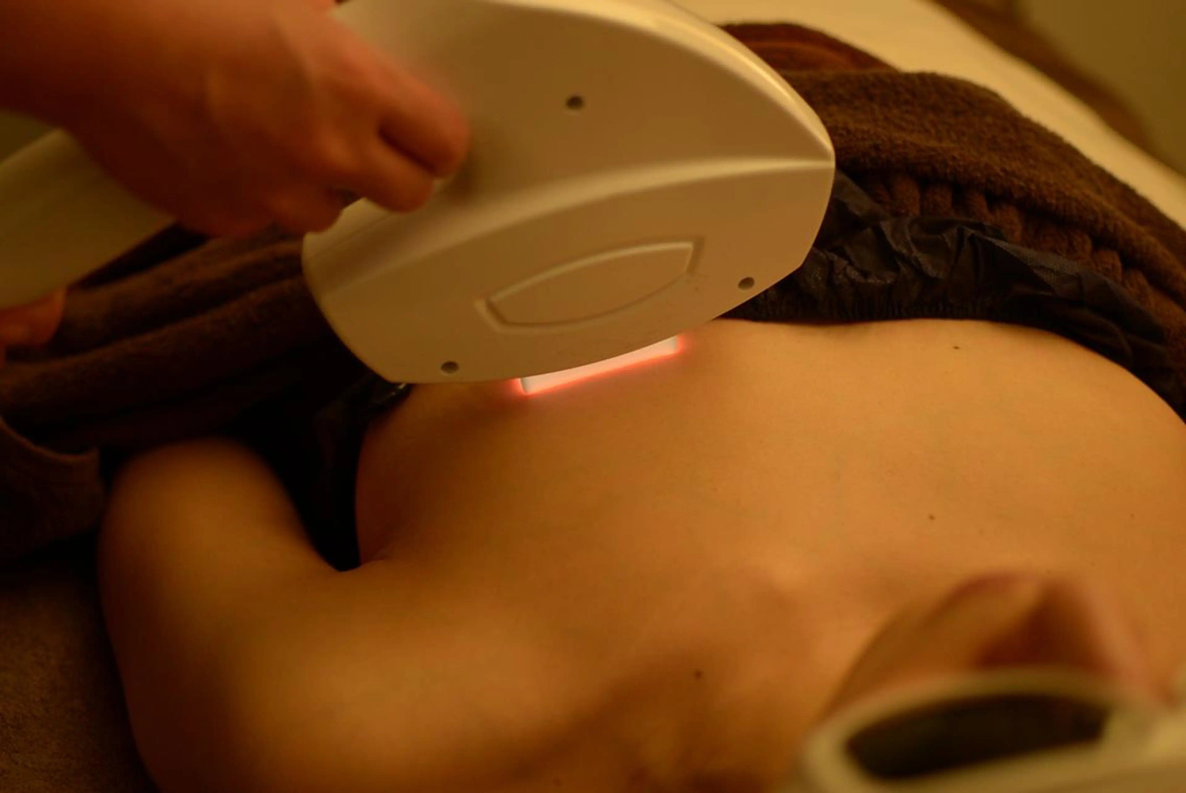 【minimo限定】ウル！プル全身脱毛➕痩身.電磁パルス¥39000→¥9600の写真