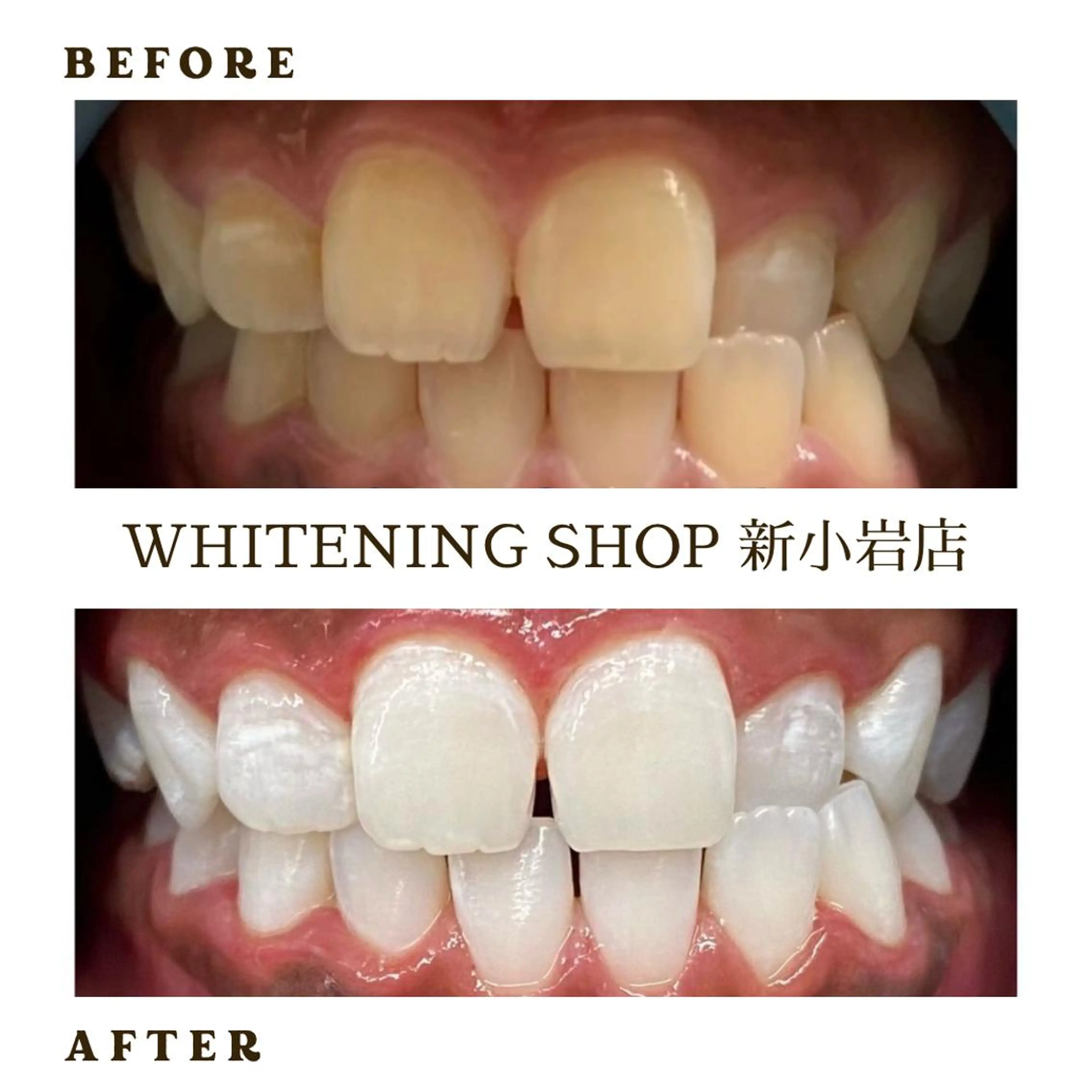 ホワイトニング ショップ新小岩店のその他イメージ